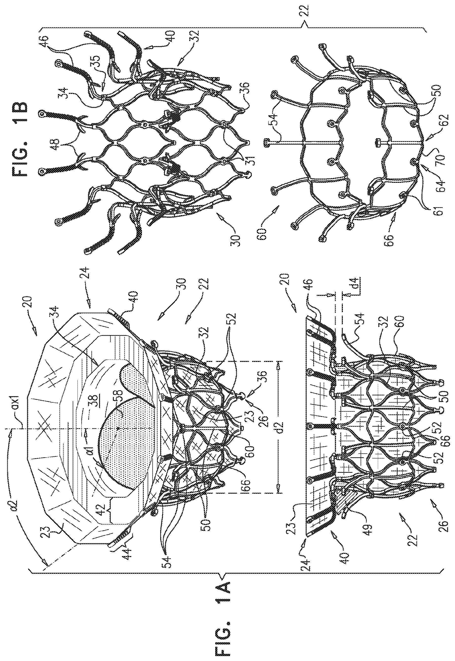 Patent US11779458 — Prosthetic valve with leaflet connectors — Figure 1