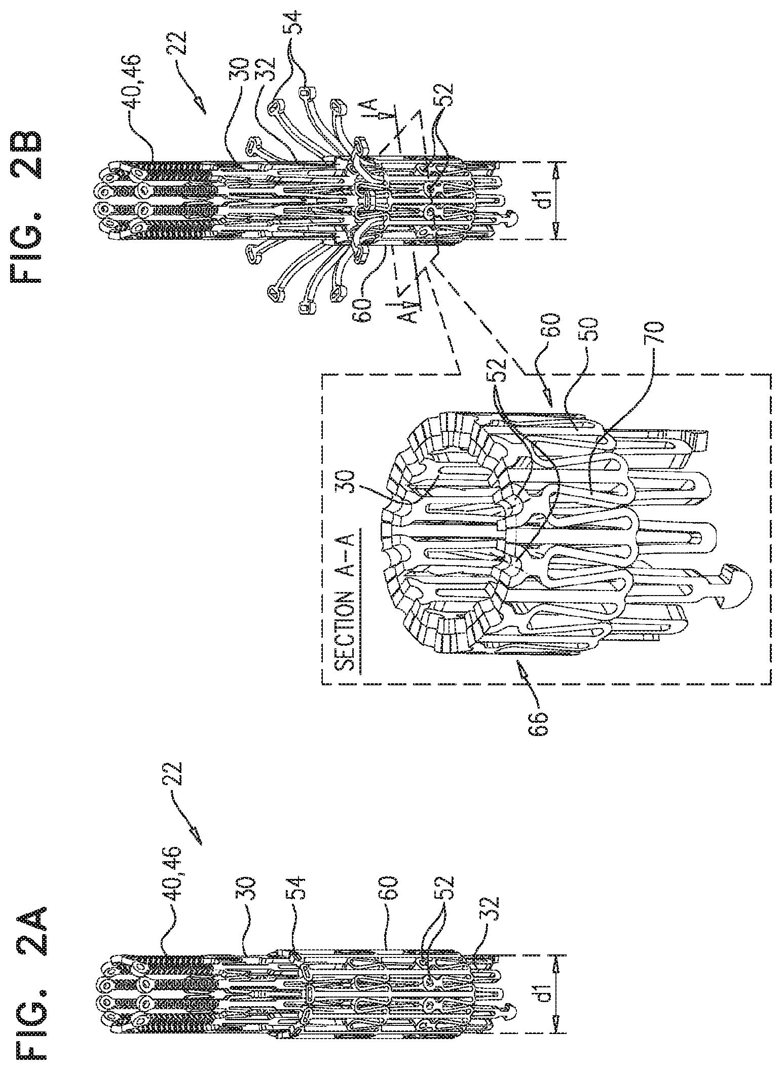 Patent US11779458 Figure 2 – Prosthetic valve with leaflet connectors