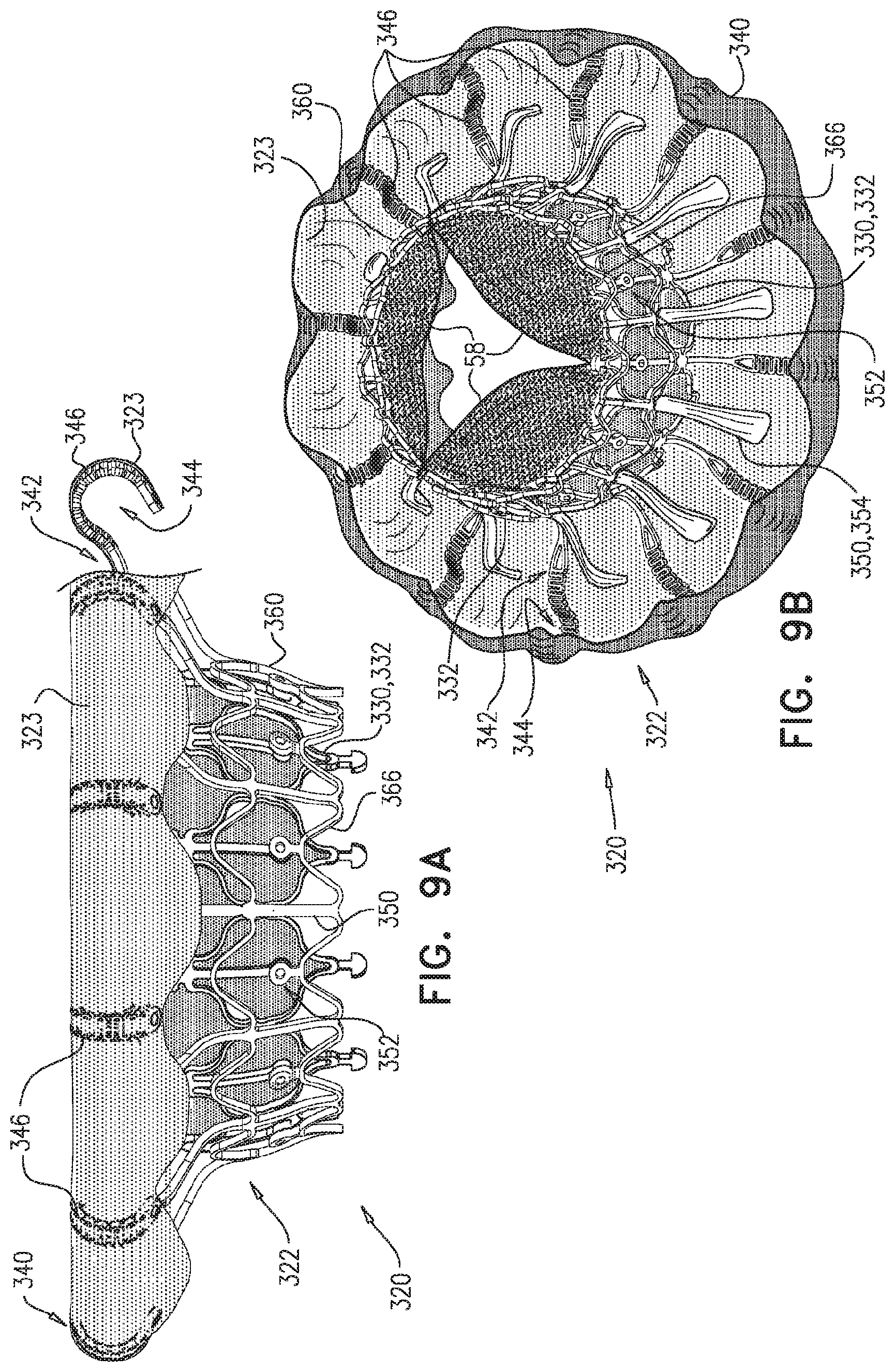 Patent US11779458 Figure 14 – Prosthetic valve with leaflet connectors