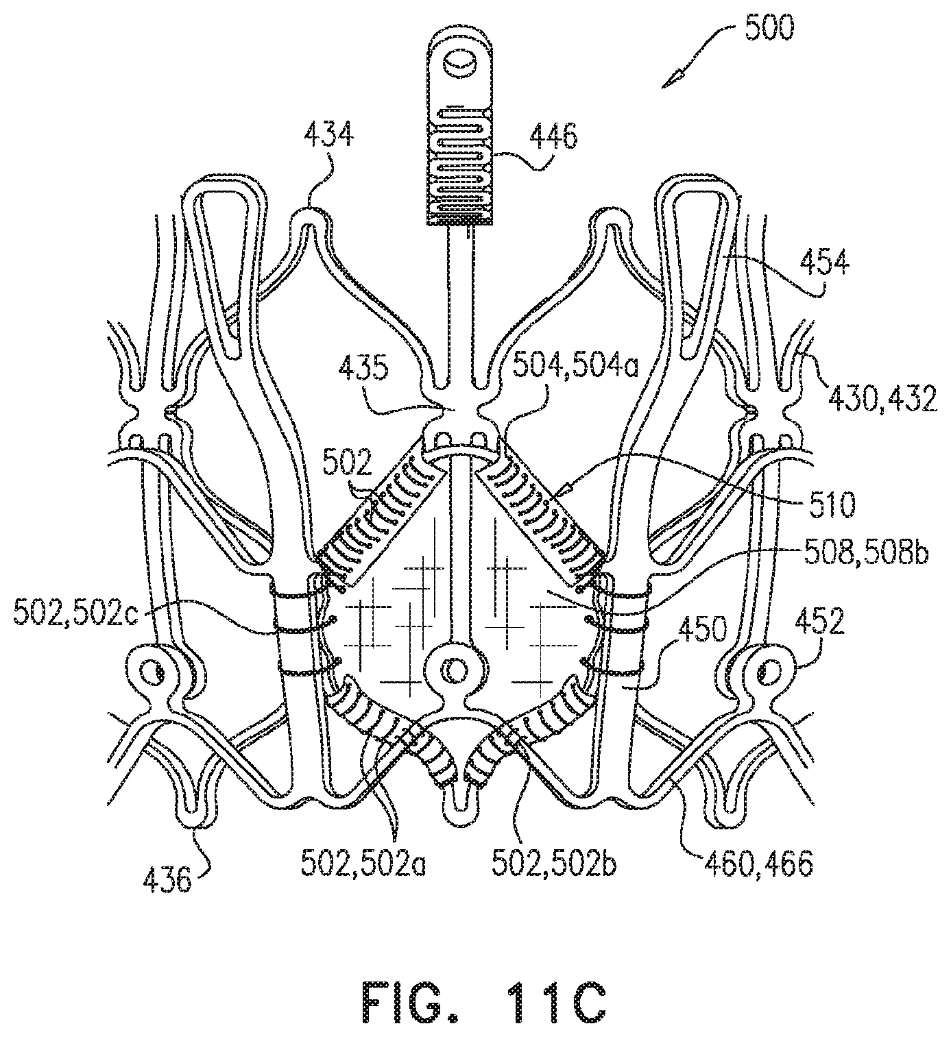 Patent US11779458 Figure 19 – Prosthetic valve with leaflet connectors