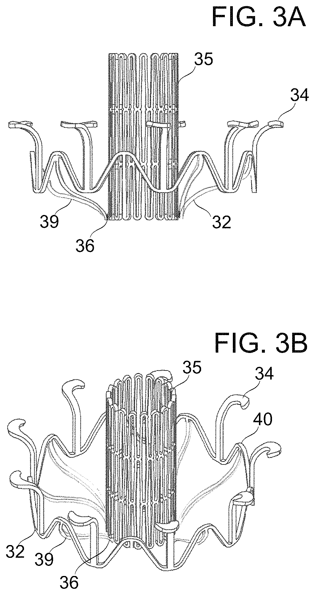 Patent US11779459 Figure 3 – Frame for prosthetic valve