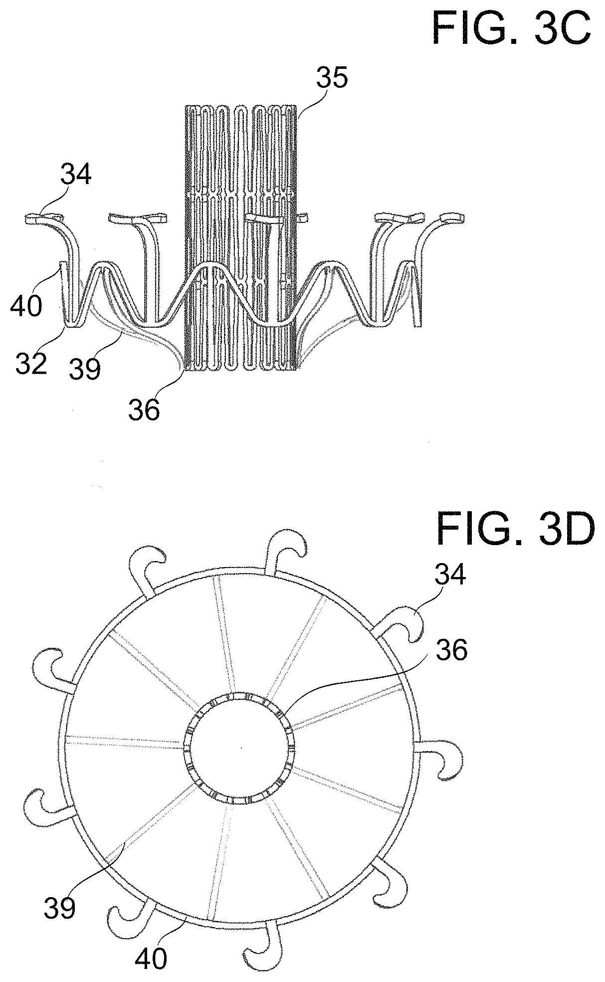 Patent US11779459 Figure 4 – Frame for prosthetic valve