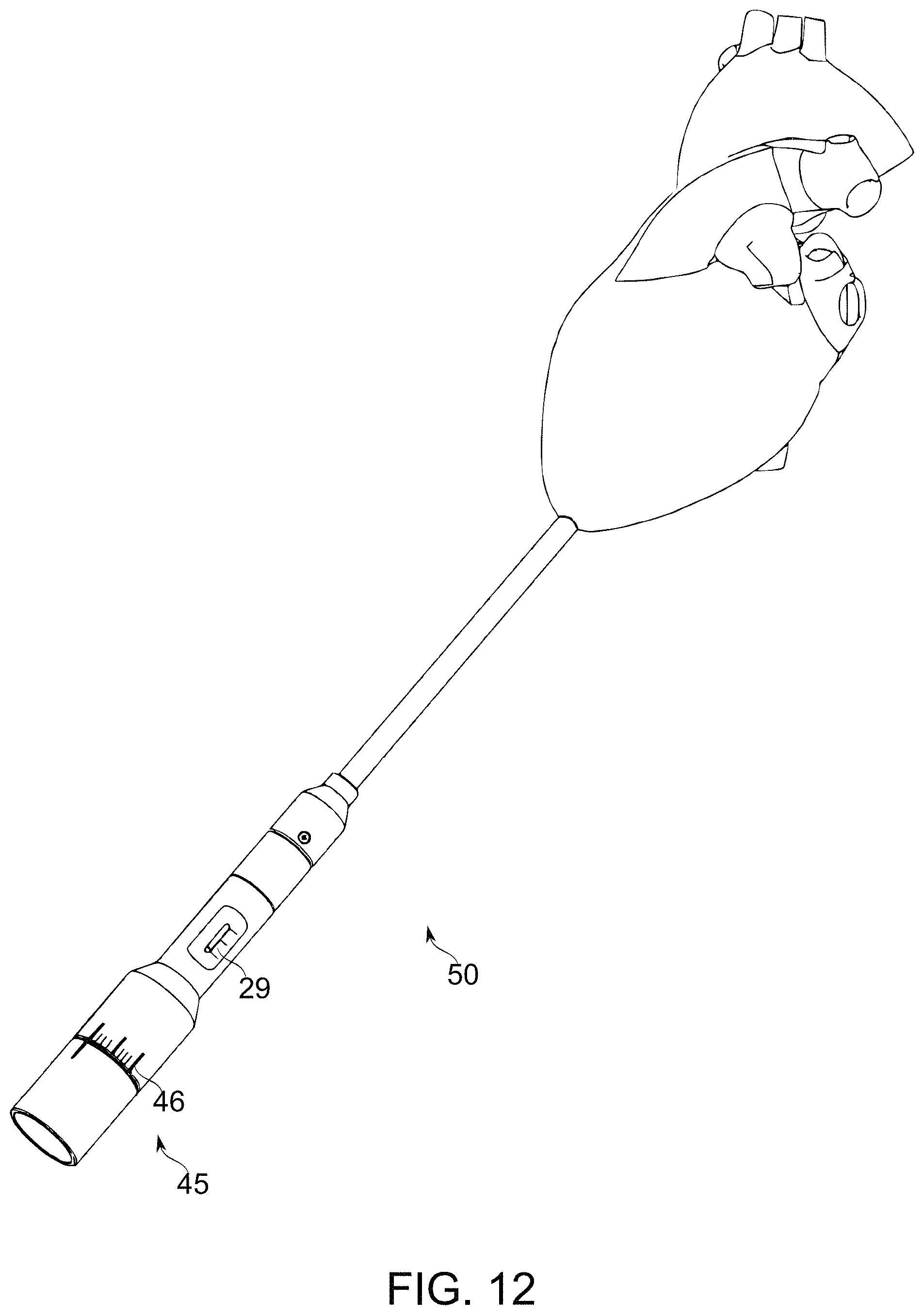 Patent US11779459 Figure 14 – Frame for prosthetic valve