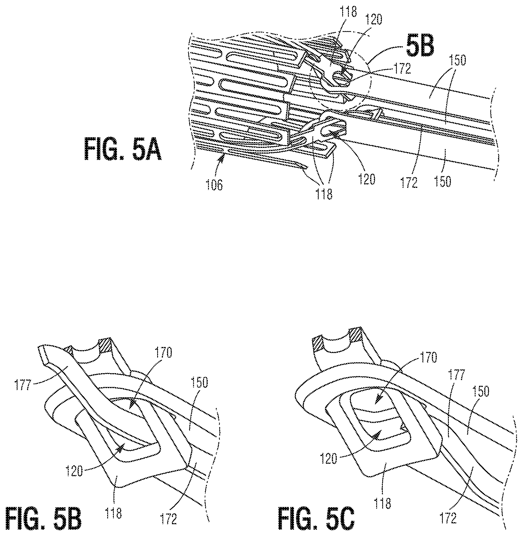 Patent US11779460 Figure 3 – Methods for controlled heart valve delivery