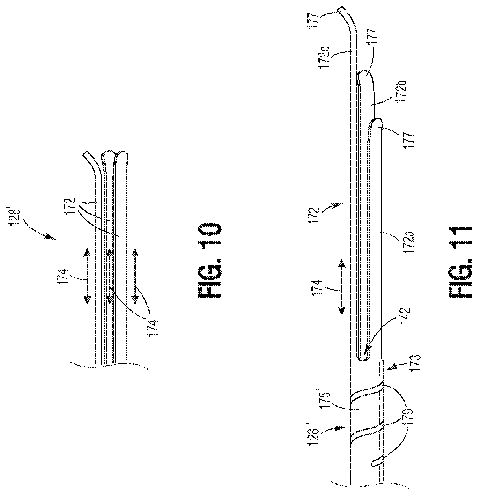 Patent US11779460 Figure 5 – Methods for controlled heart valve delivery