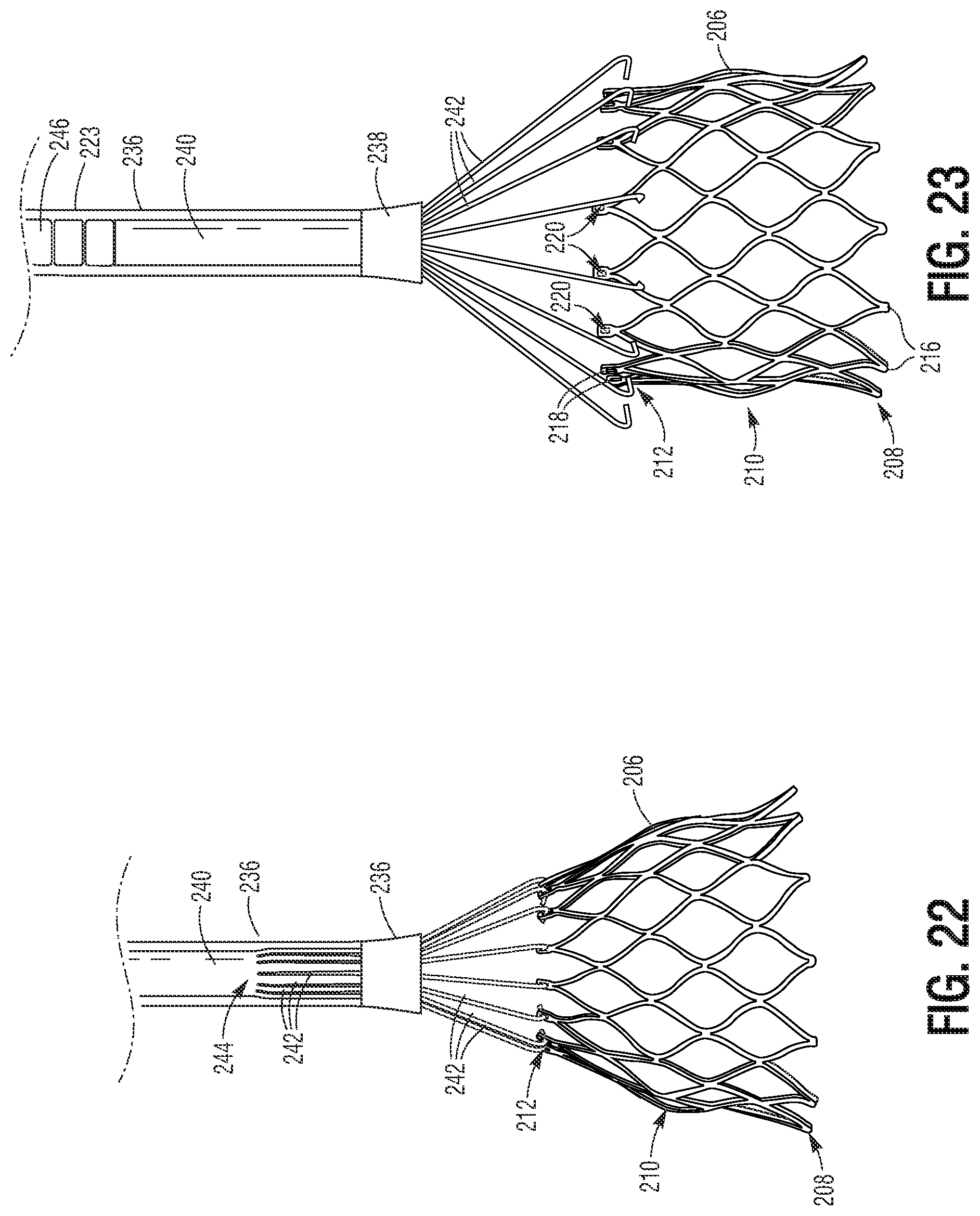 Patent US11779460 Figure 11 – Methods for controlled heart valve delivery