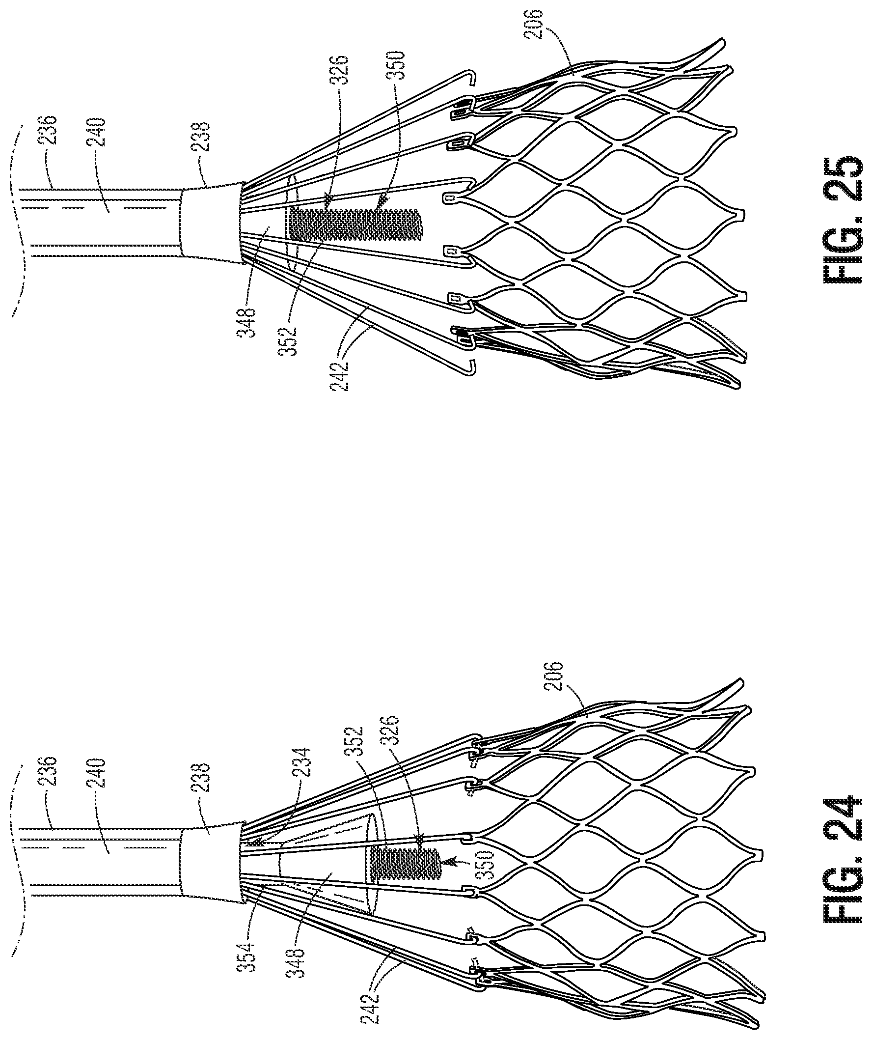Patent US11779460 Figure 12 – Methods for controlled heart valve delivery