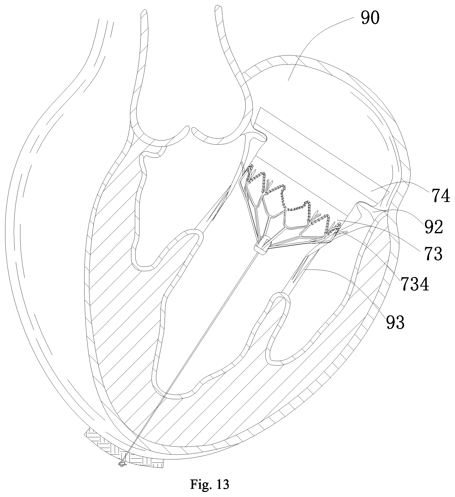 Patent US11779462 Figure 12 – Conveyor and conveyor system