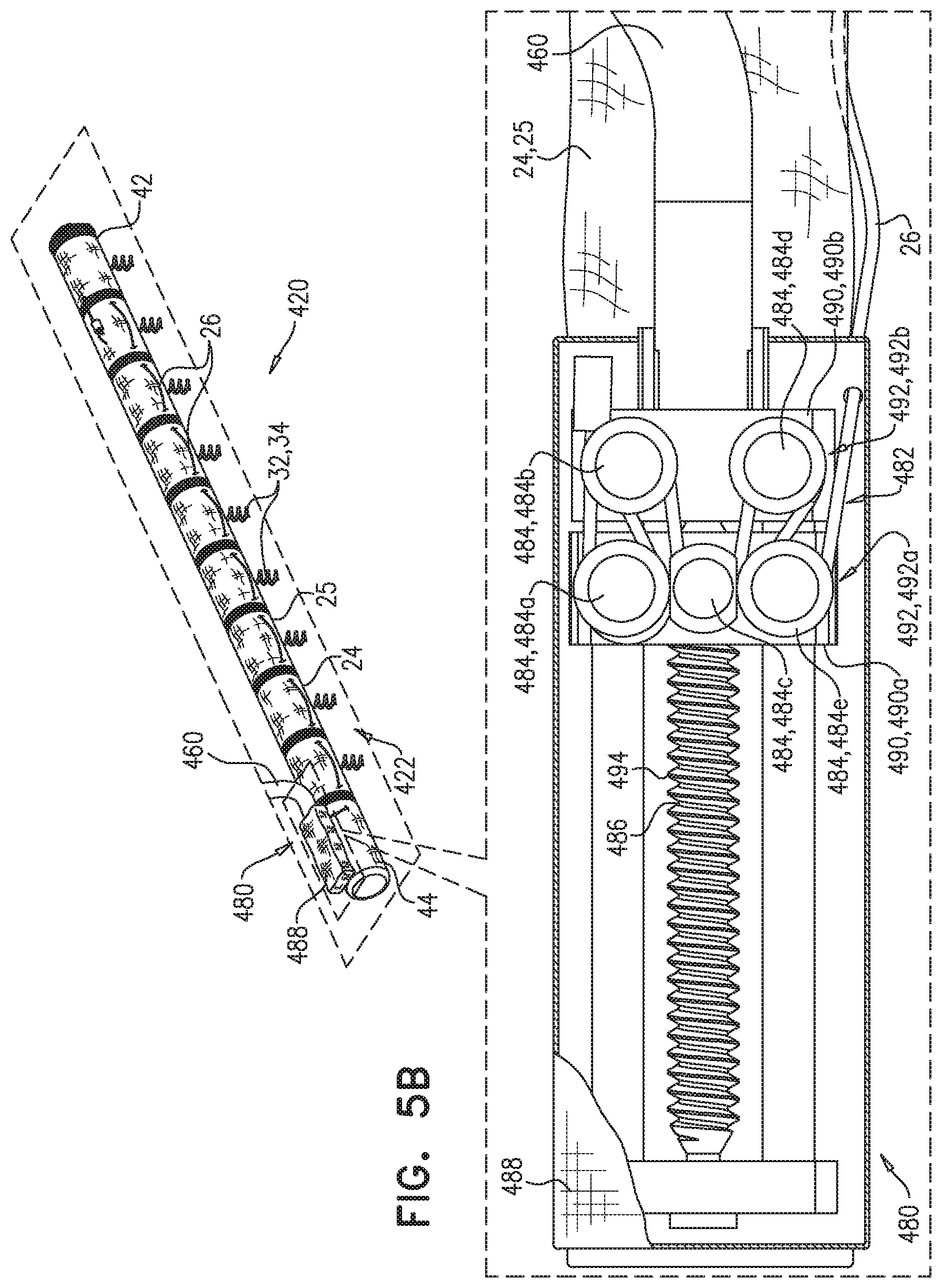 Patent US11779463 Figure 6 – Contraction of an annuloplasty structure