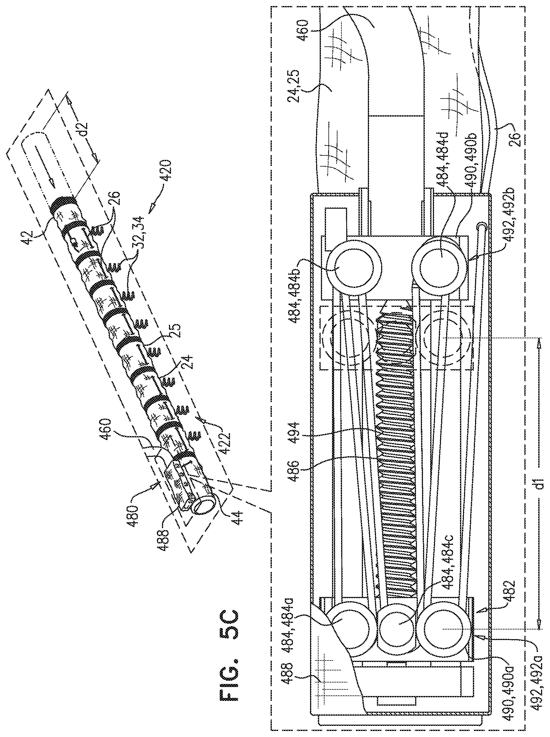 Patent US11779463 Figure 7 – Contraction of an annuloplasty structure
