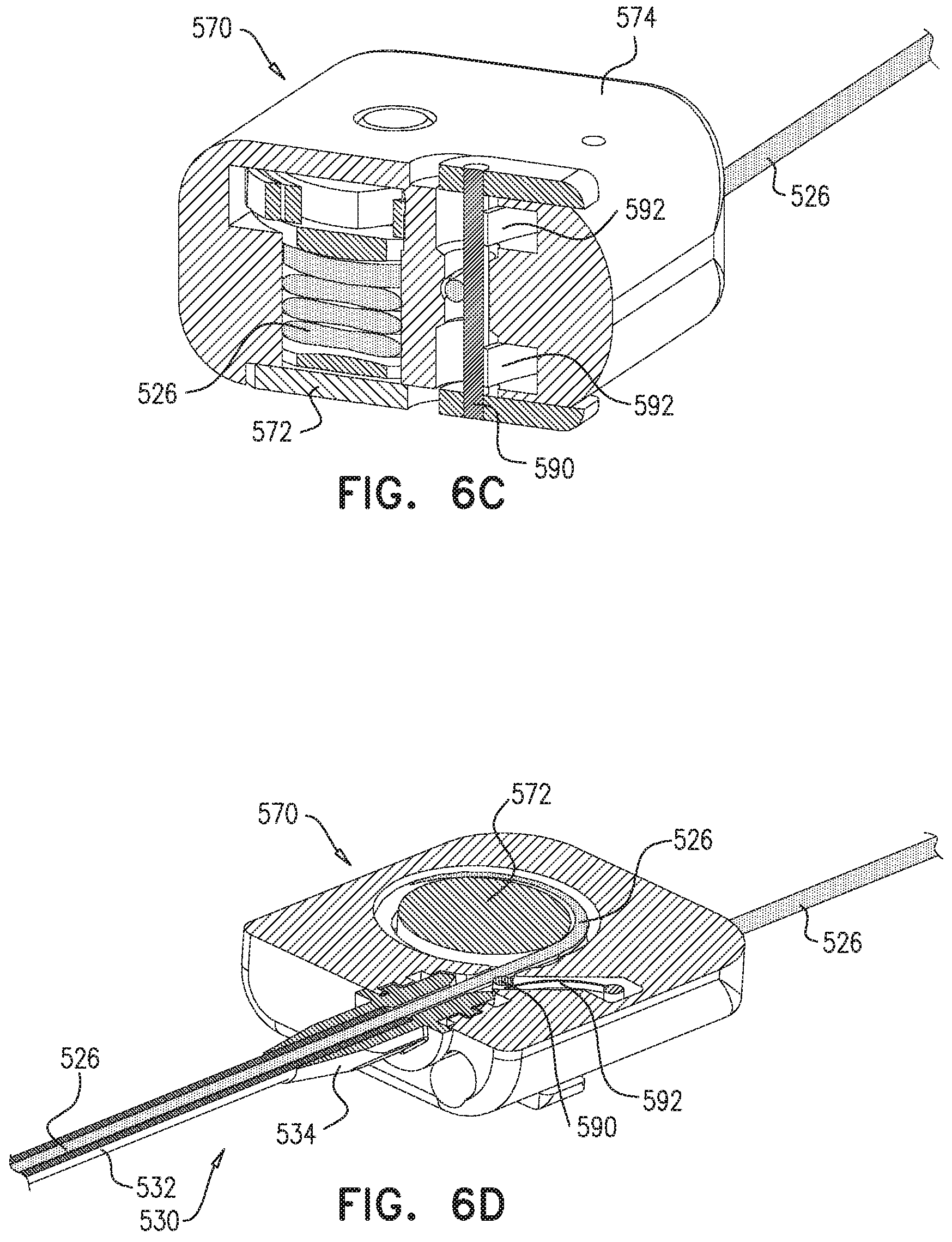 Patent US11779463 Figure 9 – Contraction of an annuloplasty structure