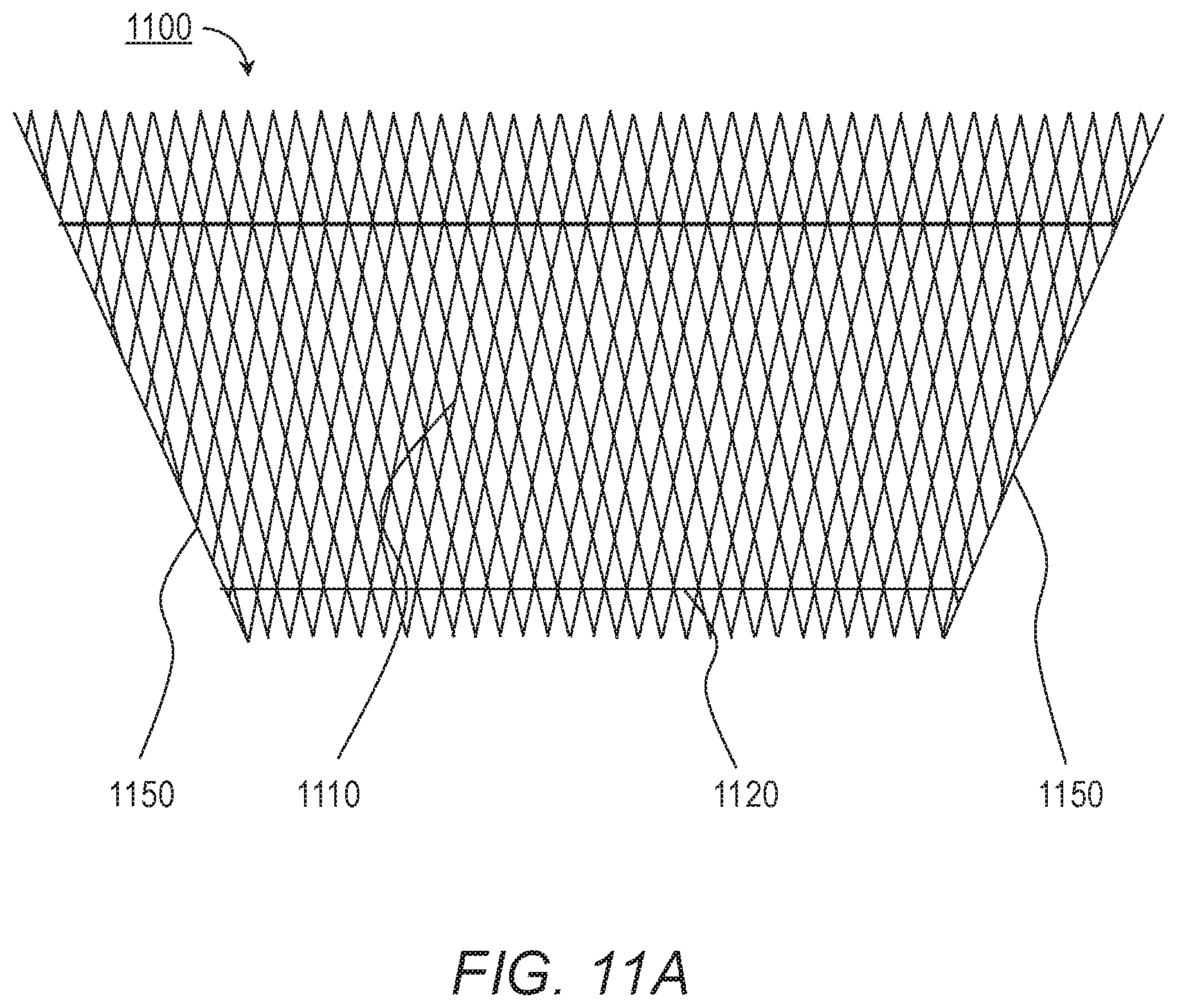 Patent US11779464 Figure 11 – Customized ventricular support device