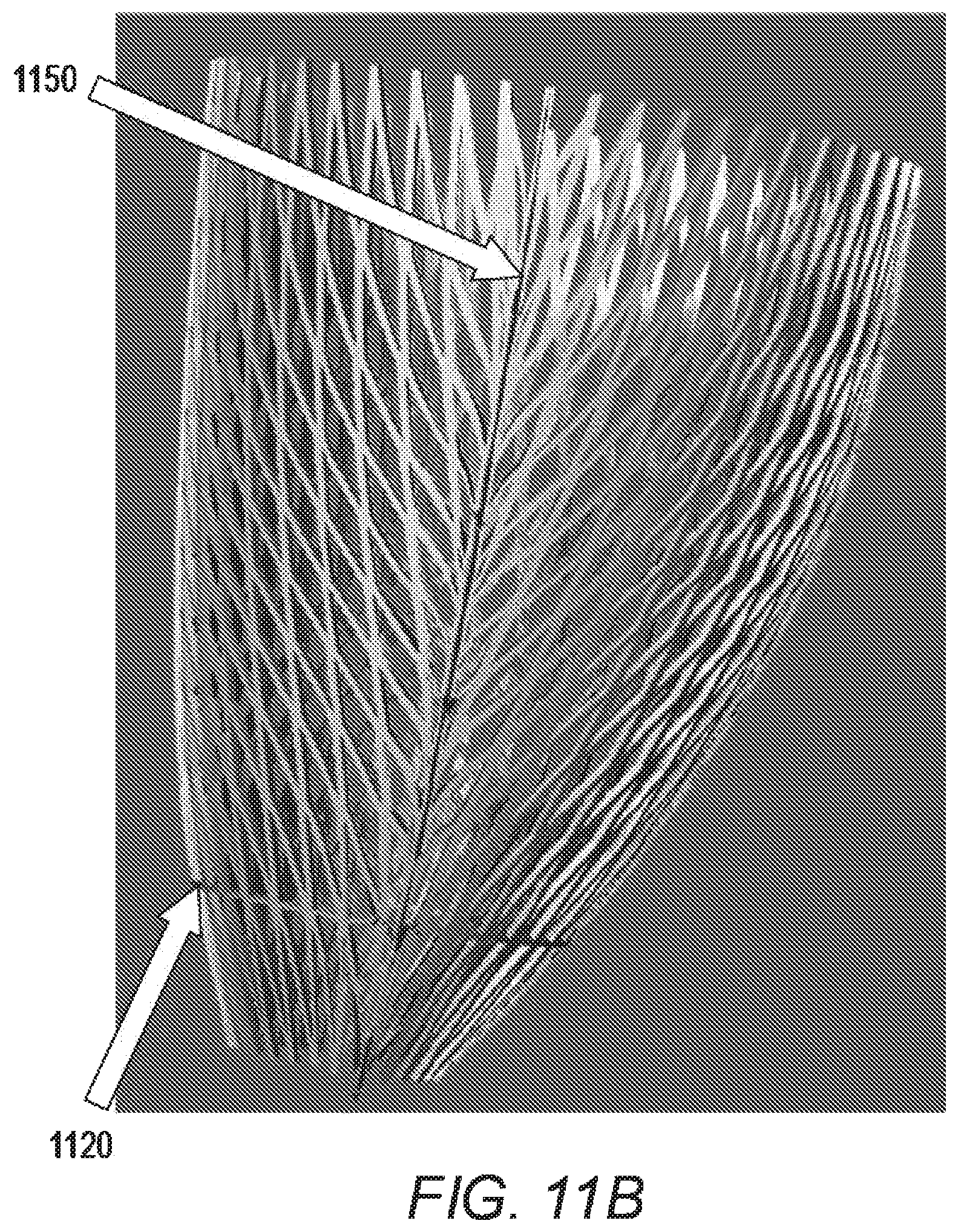 Patent US11779464 Figure 12 – Customized ventricular support device