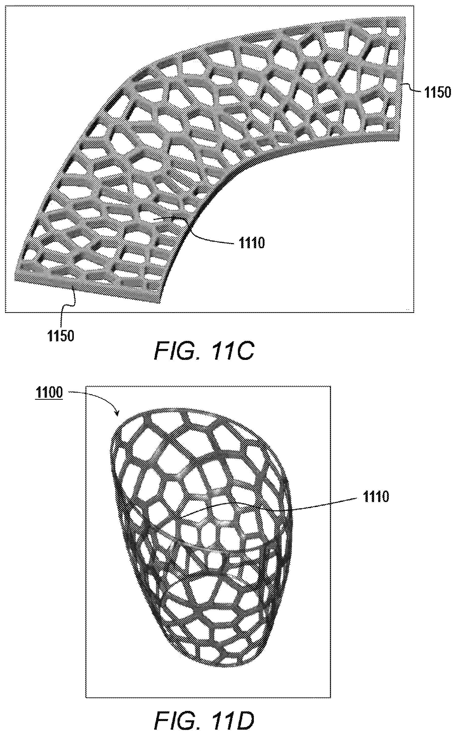 Patent US11779464 Figure 13 – Customized ventricular support device