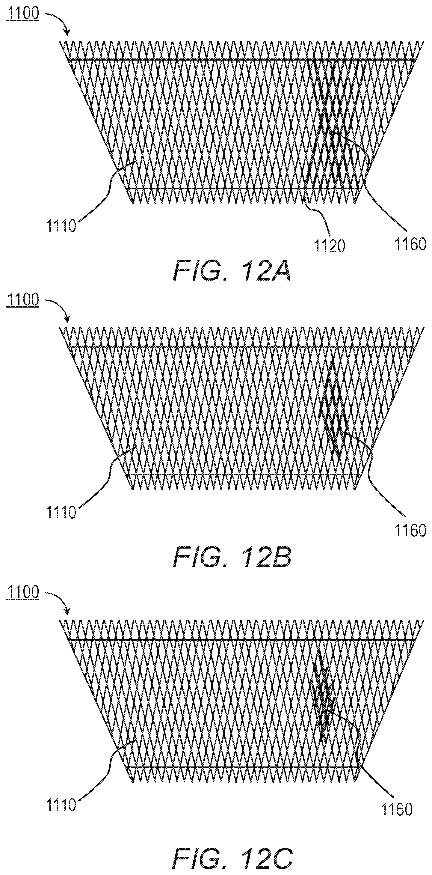 Patent US11779464 Figure 14 – Customized ventricular support device