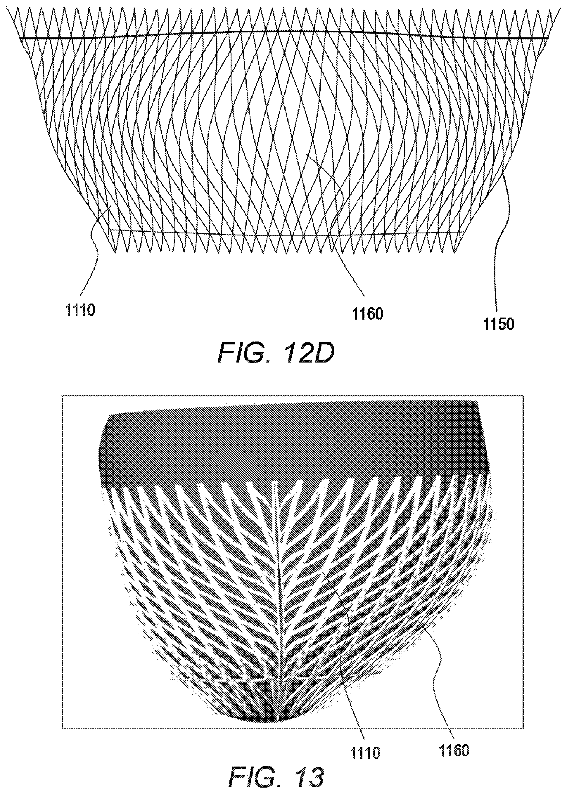 Patent US11779464 Figure 15 – Customized ventricular support device