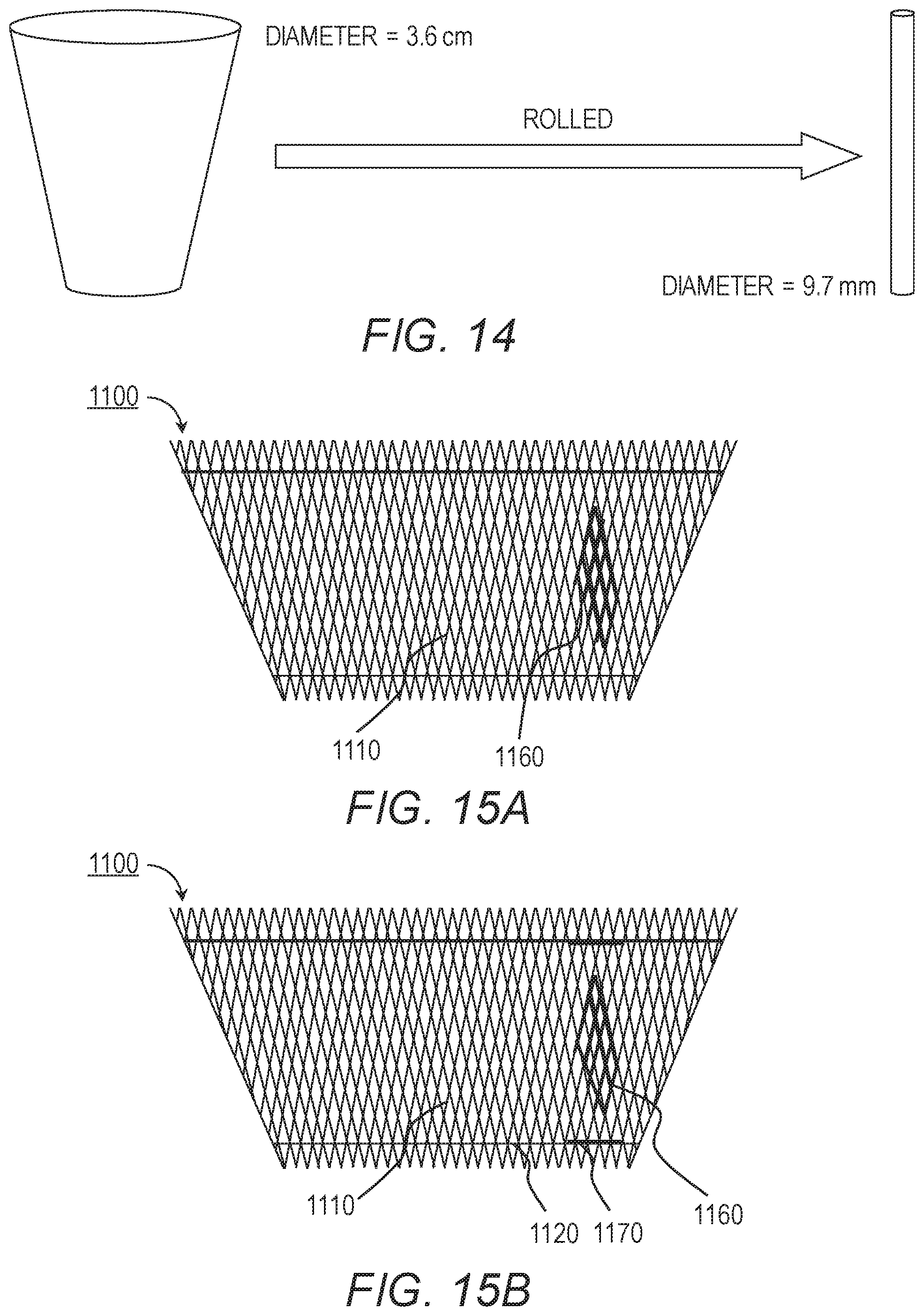 Patent US11779464 Figure 16 – Customized ventricular support device