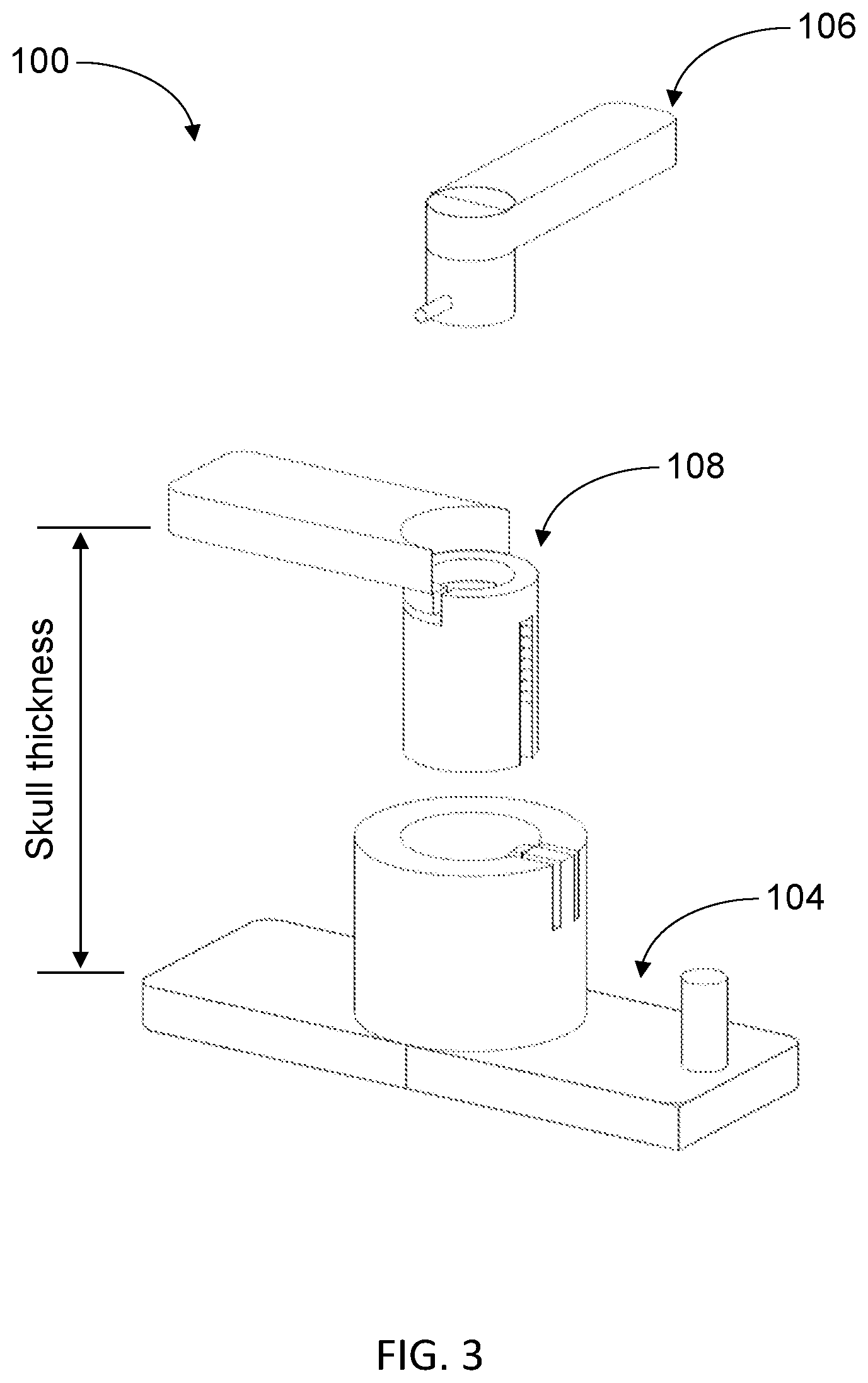 Patent US11779465 Figure 4 – Biocompatible medical device and method of making same