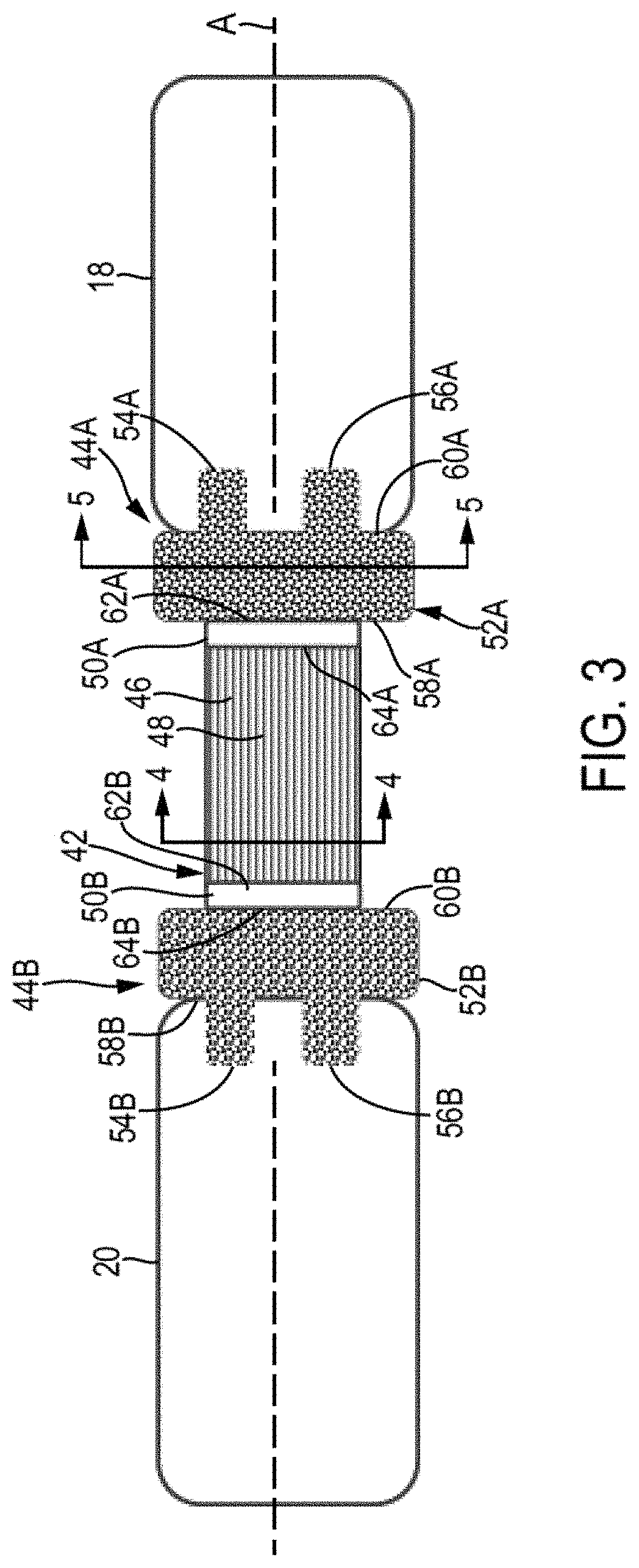 Patent US11779467 Figure 3 – Metarsophalangeal joint replacement device and methods