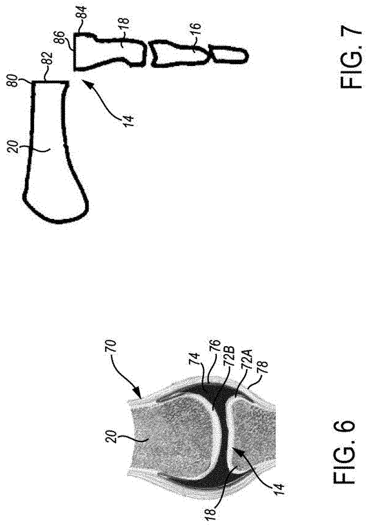 Patent US11779467 Figure 5 – Metarsophalangeal joint replacement device and methods