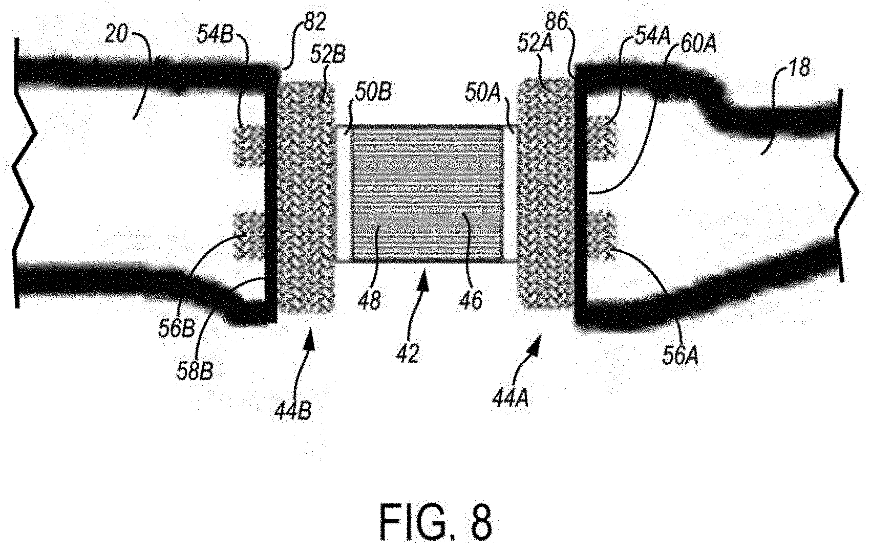 Patent US11779467 Figure 6 – Metarsophalangeal joint replacement device and methods