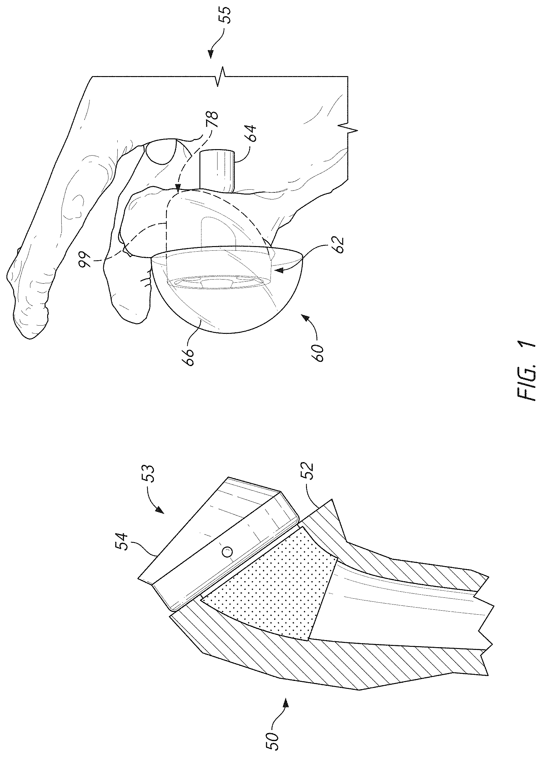 Patent US11779471 Figure 1 – Apparatuses and methods for implanting glenoid prostheses