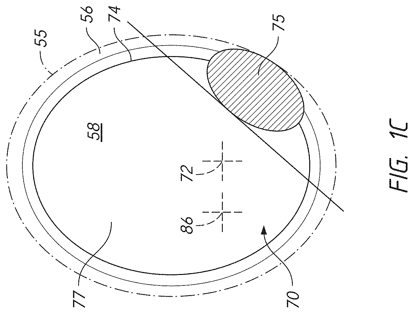Patent US11779471 Figure 4 – Apparatuses and methods for implanting glenoid prostheses