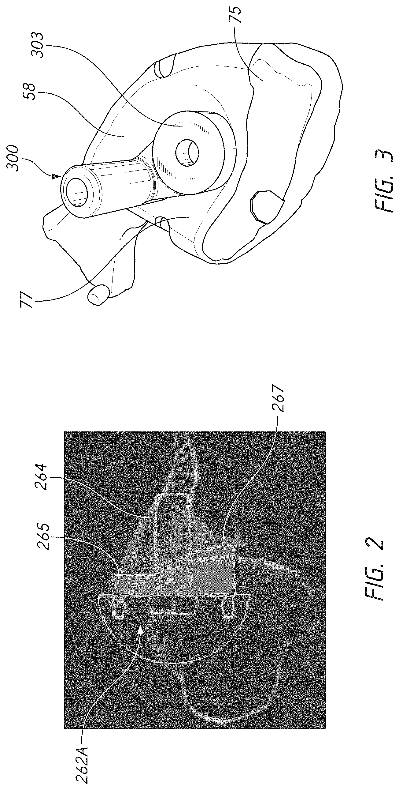 Patent US11779471 Figure 5 – Apparatuses and methods for implanting glenoid prostheses