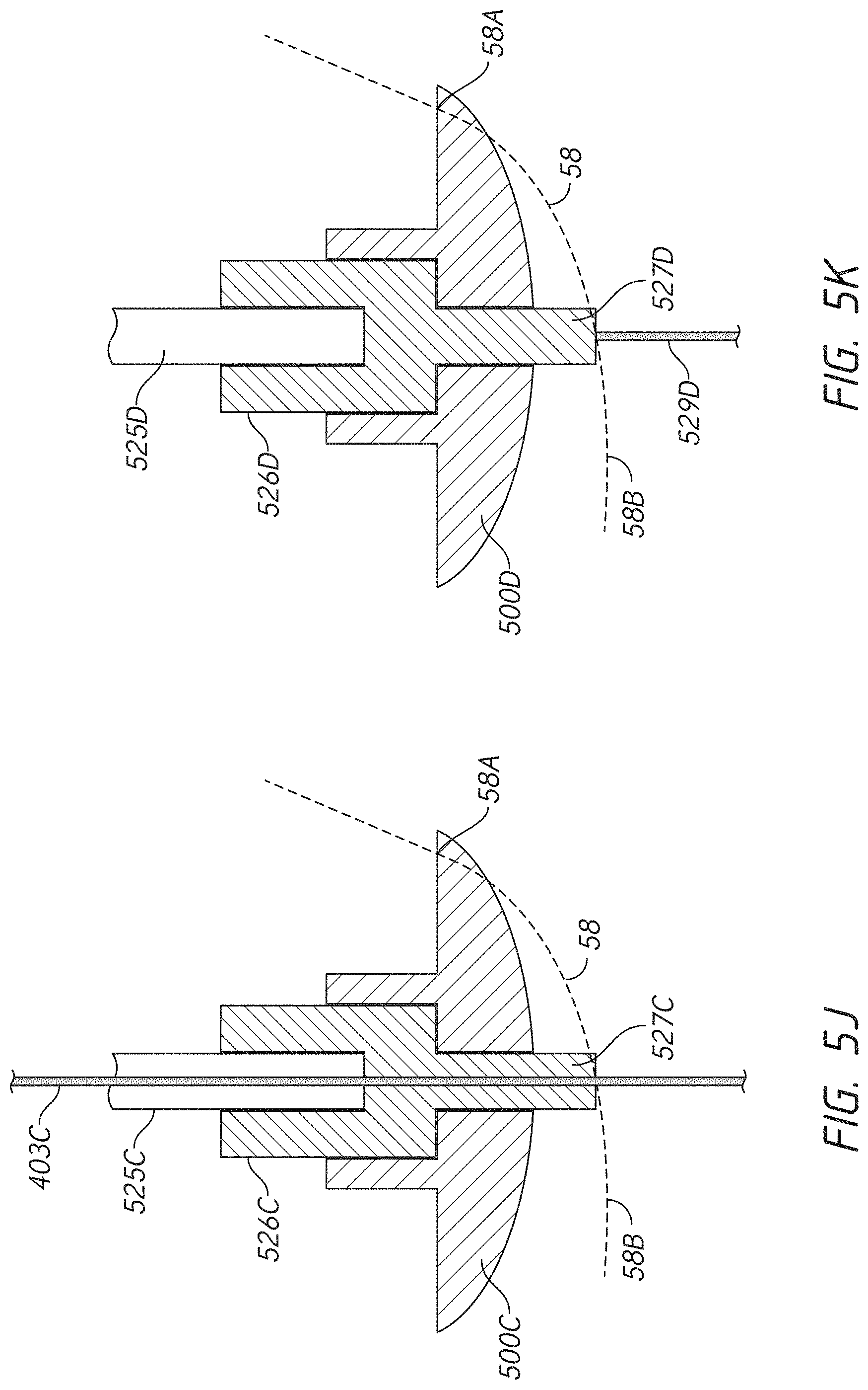 Patent US11779471 Figure 14 – Apparatuses and methods for implanting glenoid prostheses
