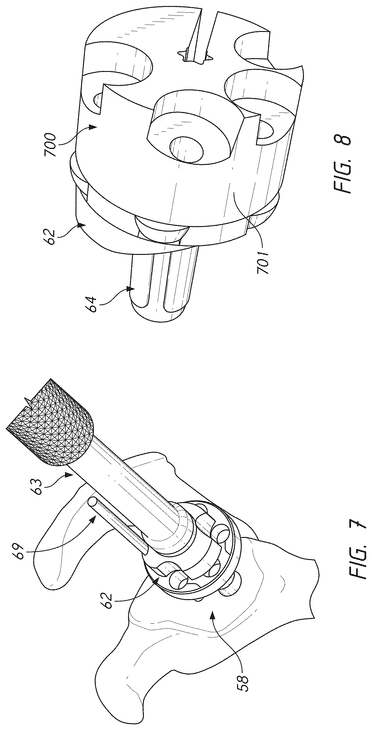 Patent US11779471 Figure 17 – Apparatuses and methods for implanting glenoid prostheses