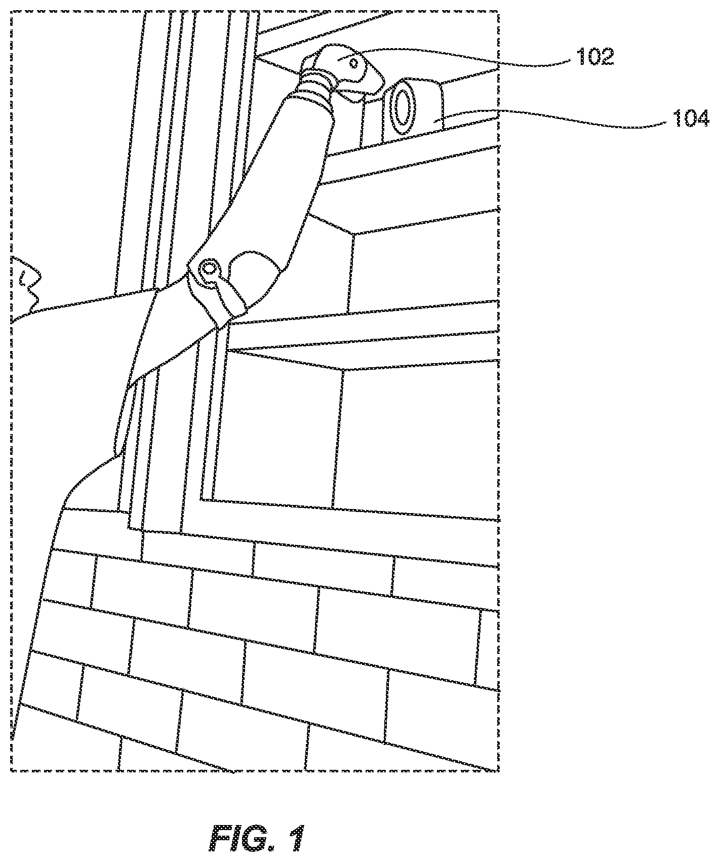 Patent US11779473 — Powered prosthetic flexion device — Figure 1