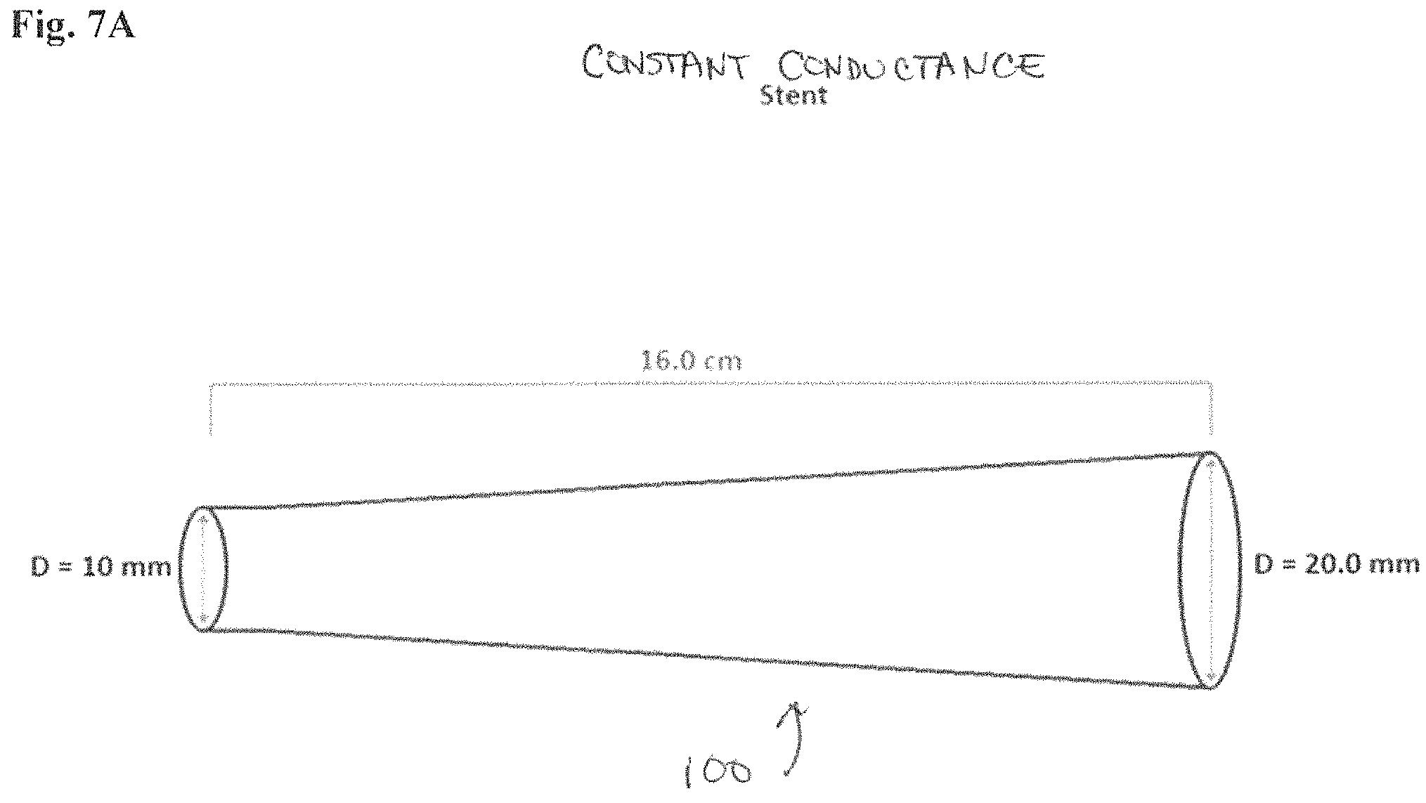 Patent US11779478 Figure 12 – Venous and arterial application of an increased volumetric flow stent and matching balloon