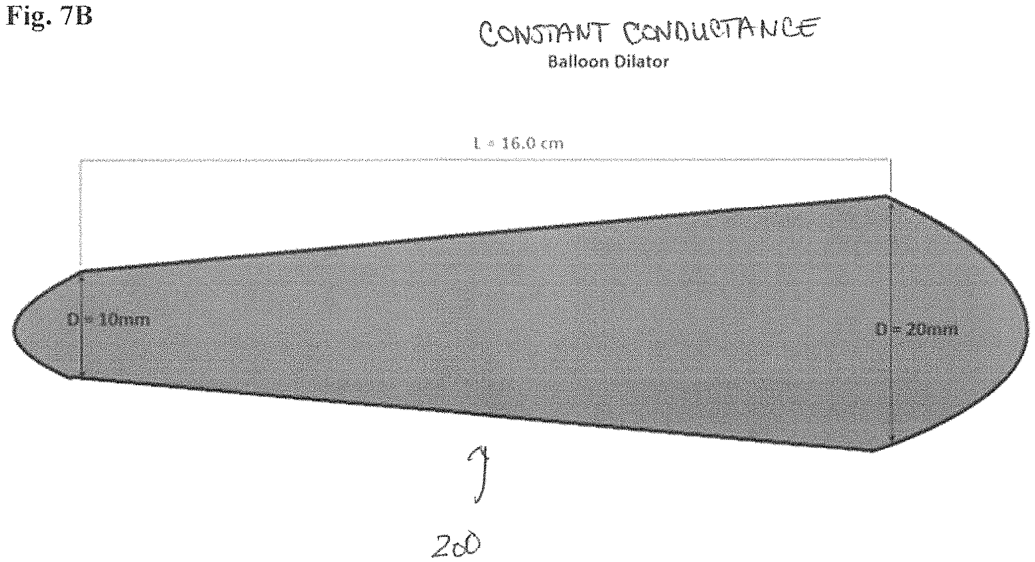 Patent US11779478 Figure 13 – Venous and arterial application of an increased volumetric flow stent and matching balloon