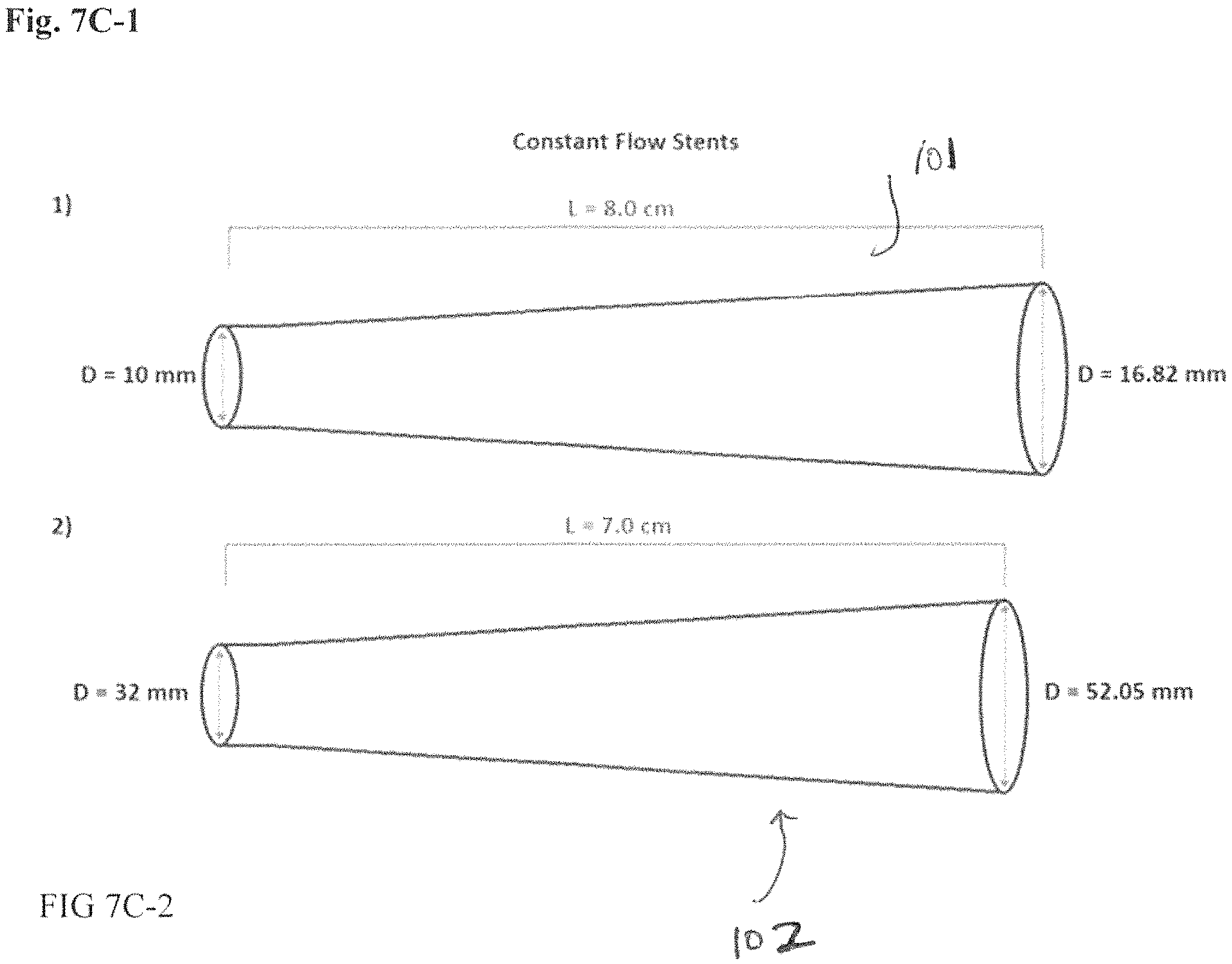 Patent US11779478 Figure 14 – Venous and arterial application of an increased volumetric flow stent and matching balloon