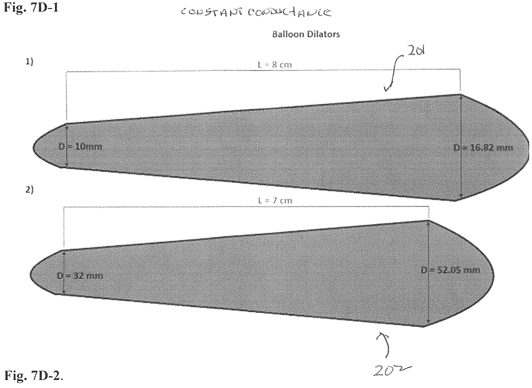 Patent US11779478 Figure 15 – Venous and arterial application of an increased volumetric flow stent and matching balloon