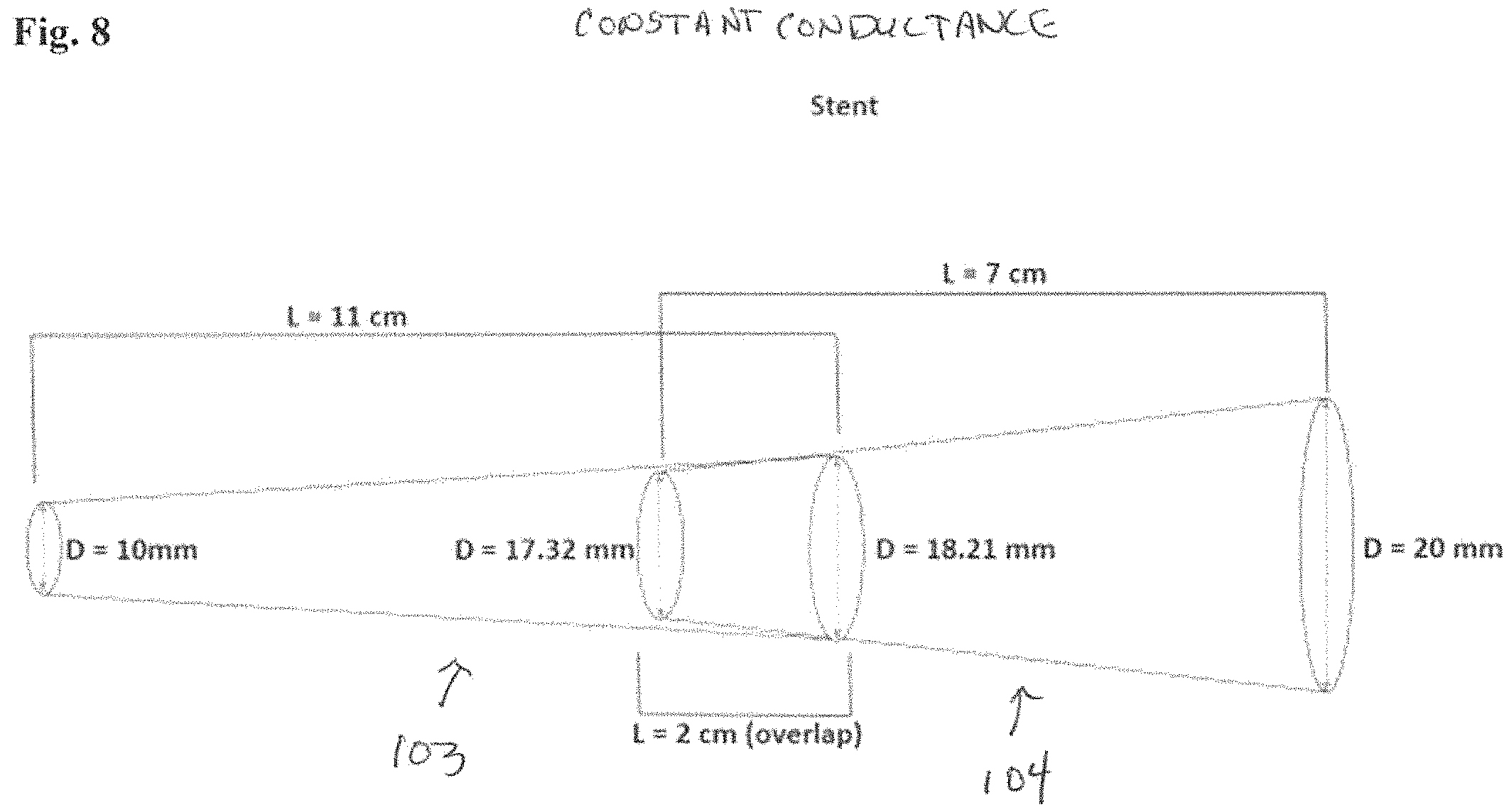 Patent US11779478 Figure 16 – Venous and arterial application of an increased volumetric flow stent and matching balloon