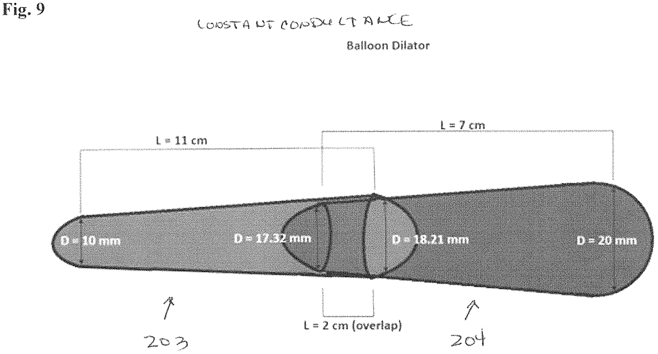 Patent US11779478 Figure 17 – Venous and arterial application of an increased volumetric flow stent and matching balloon