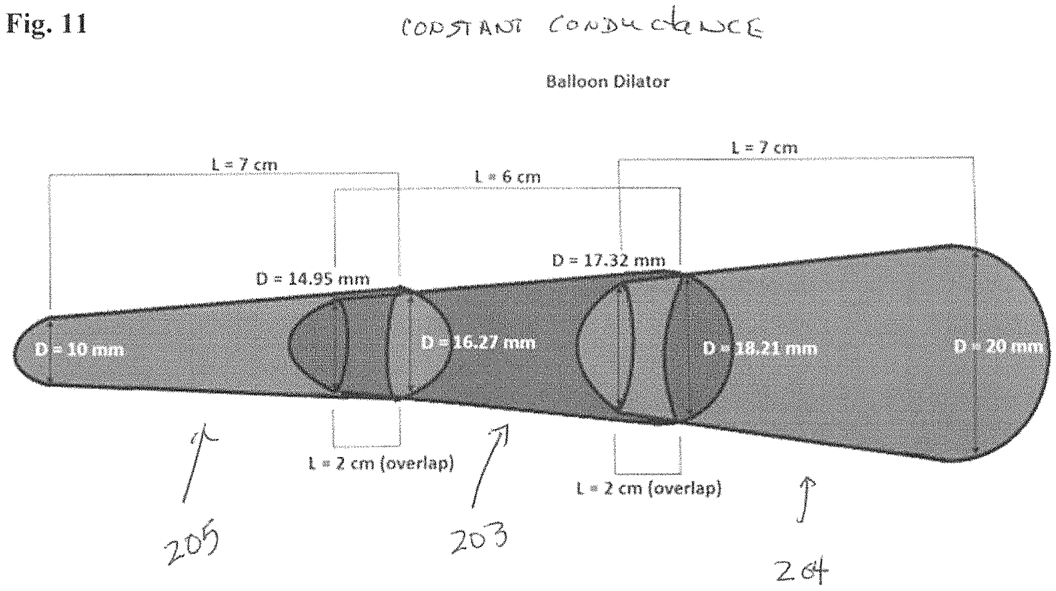 Patent US11779478 Figure 19 – Venous and arterial application of an increased volumetric flow stent and matching balloon