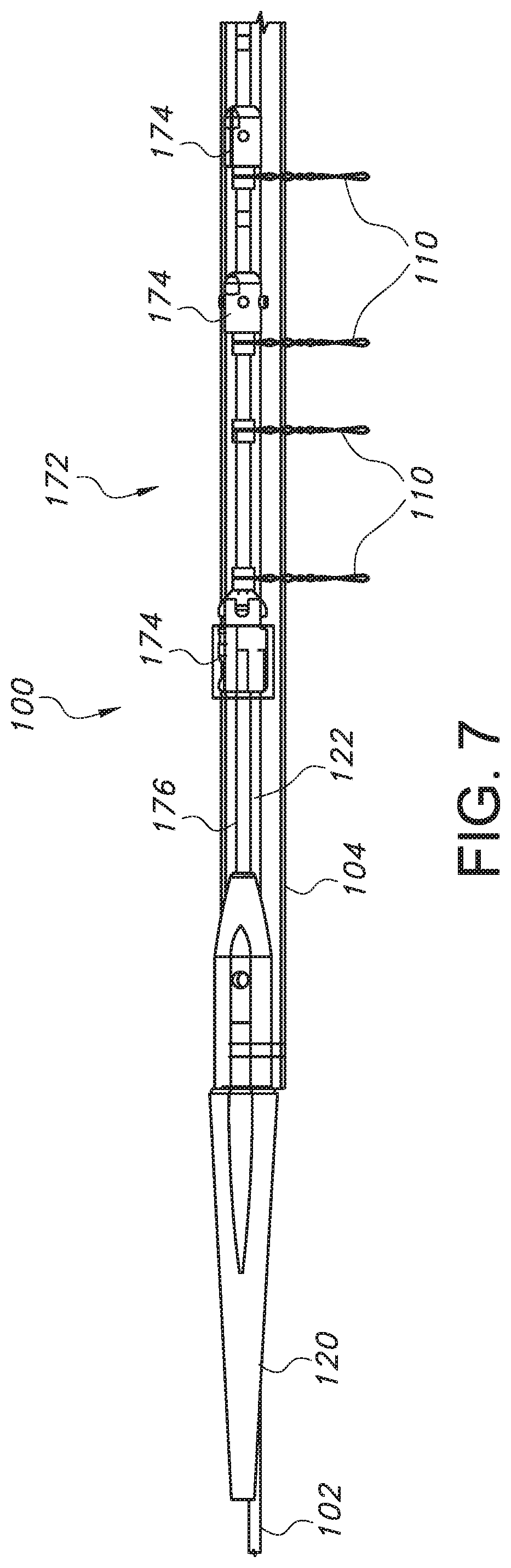 Patent US11779479 Figure 7 – Bifurcated endovascular prosthesis having tethered contralateral leg