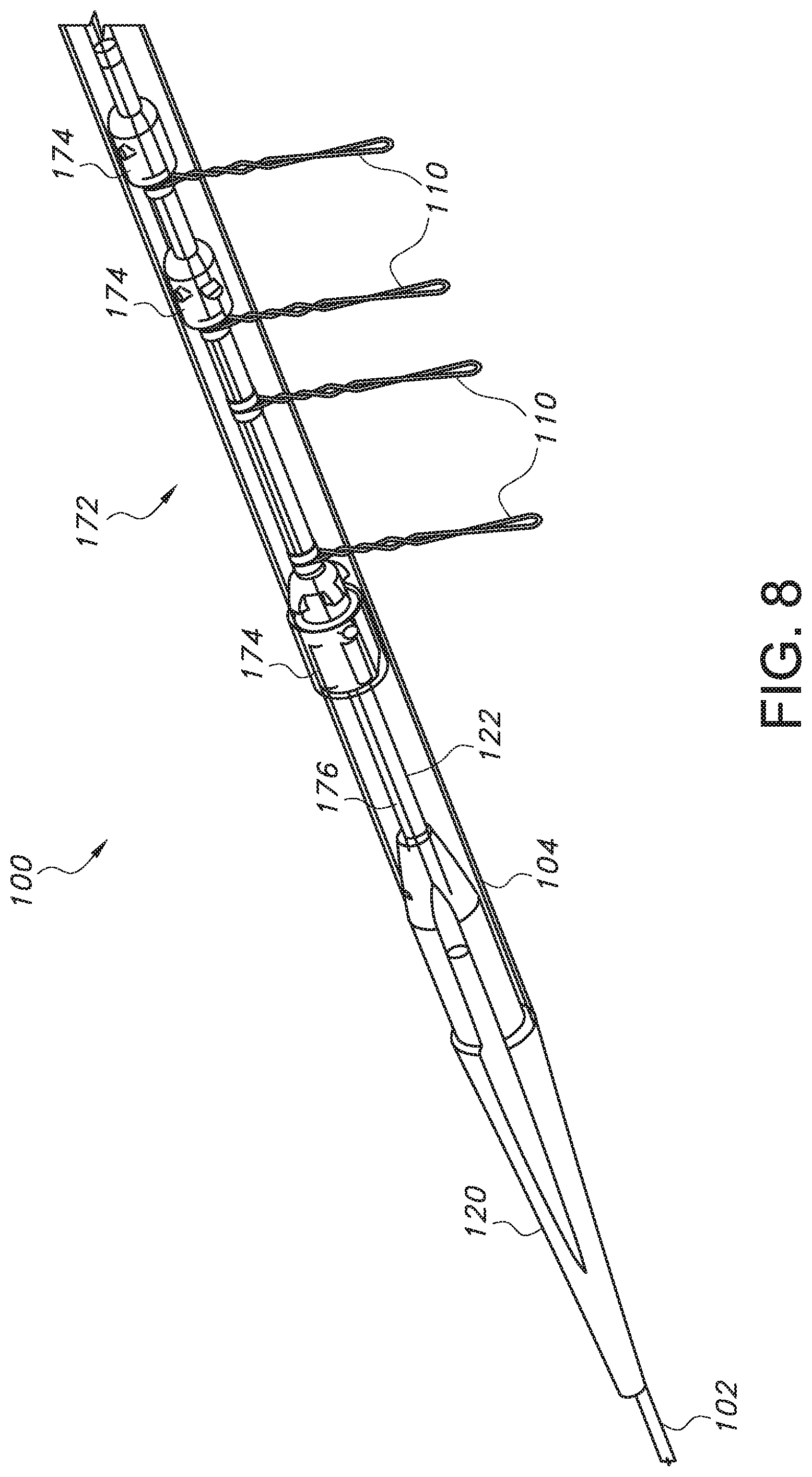 Patent US11779479 Figure 8 – Bifurcated endovascular prosthesis having tethered contralateral leg