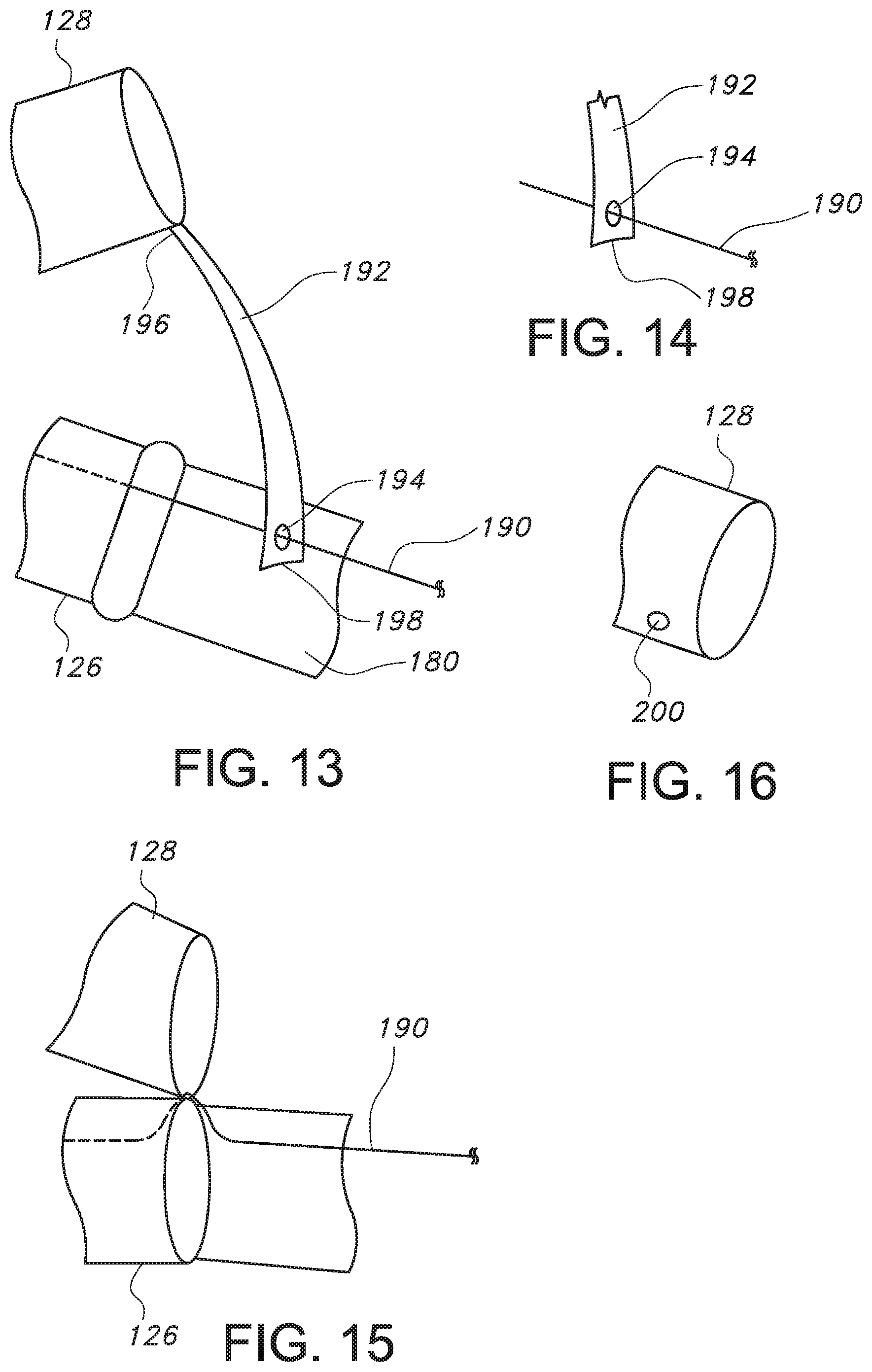 Patent US11779479 Figure 10 – Bifurcated endovascular prosthesis having tethered contralateral leg
