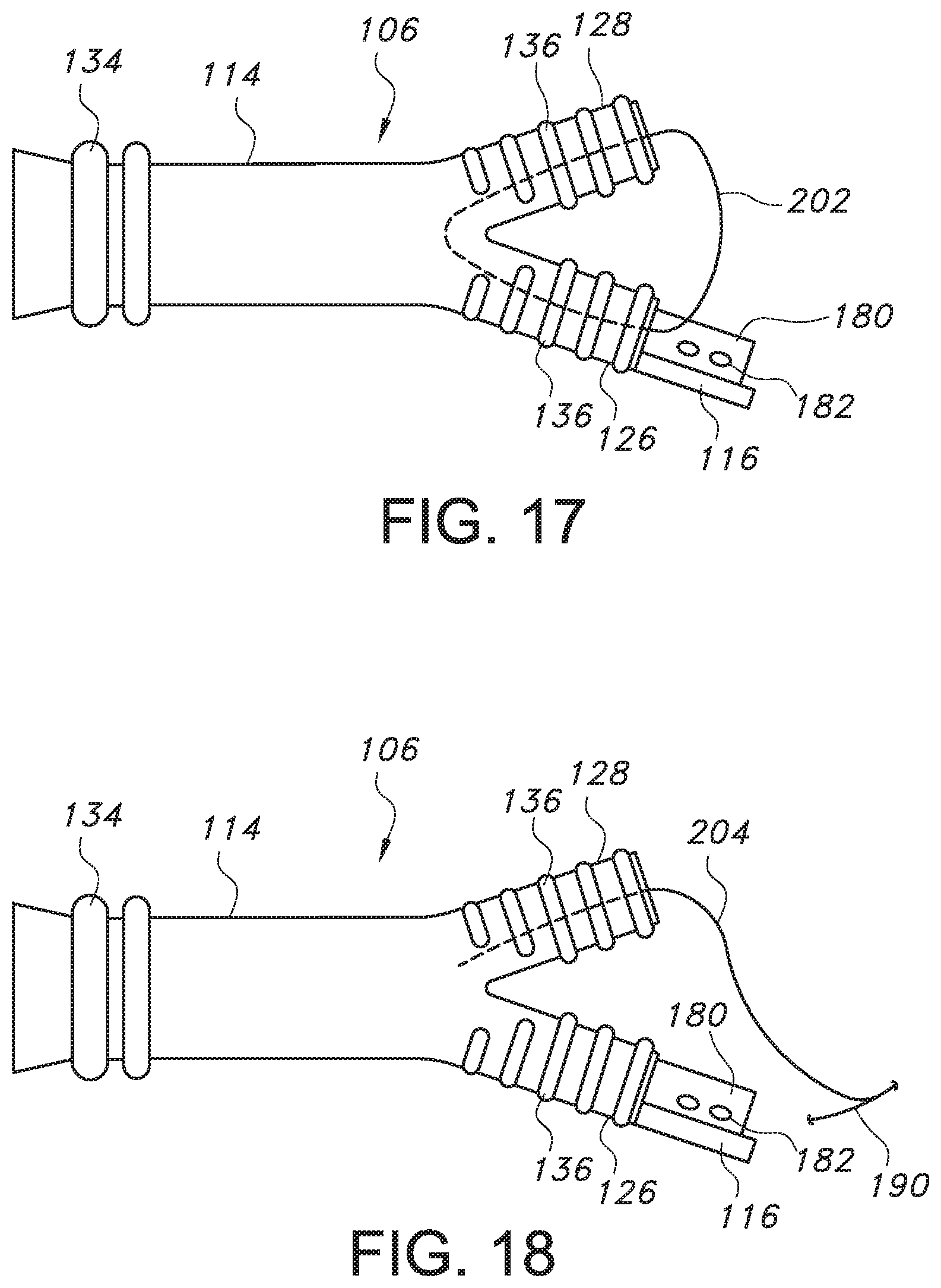 Patent US11779479 Figure 11 – Bifurcated endovascular prosthesis having tethered contralateral leg