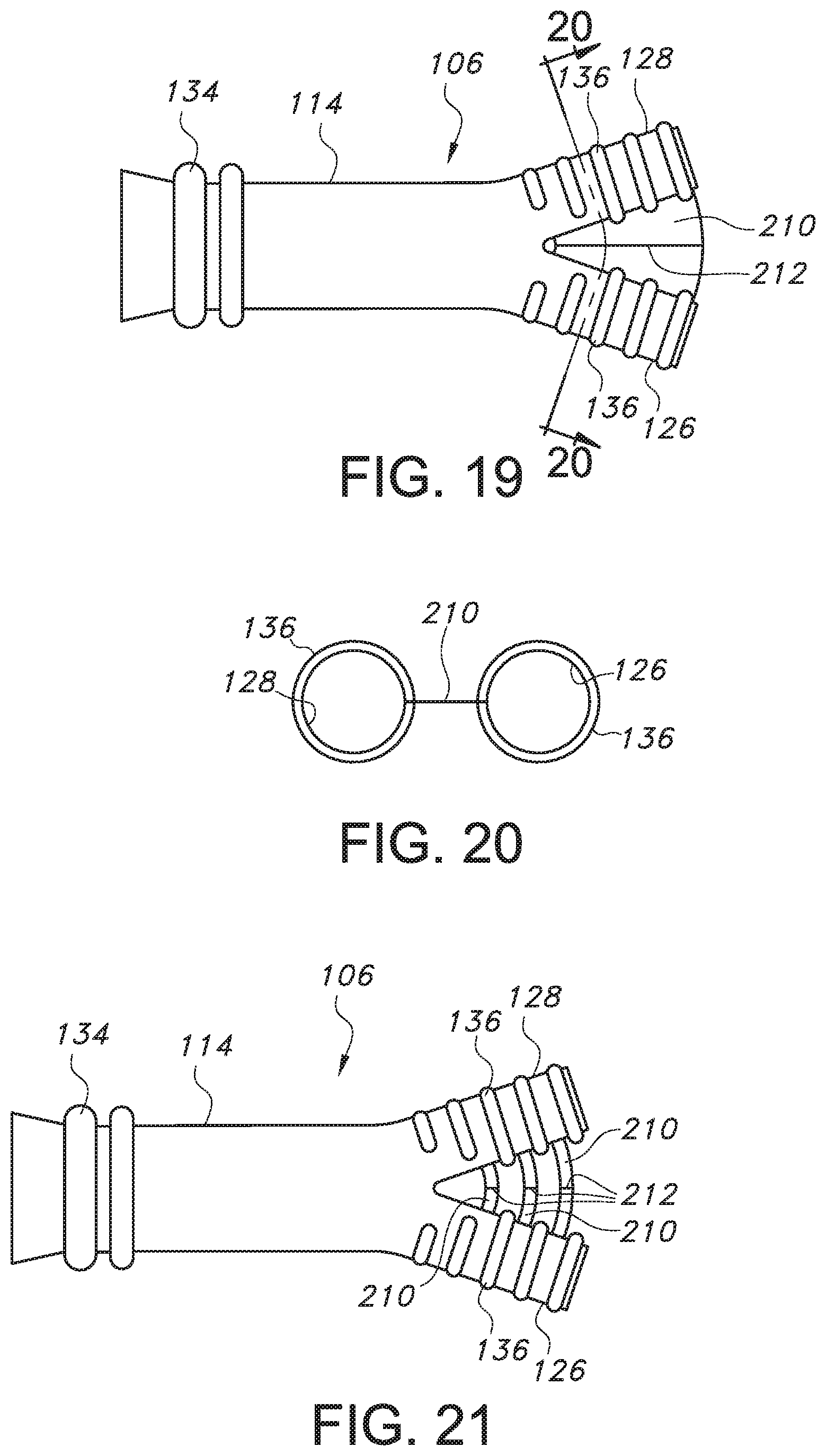 Patent US11779479 Figure 12 – Bifurcated endovascular prosthesis having tethered contralateral leg