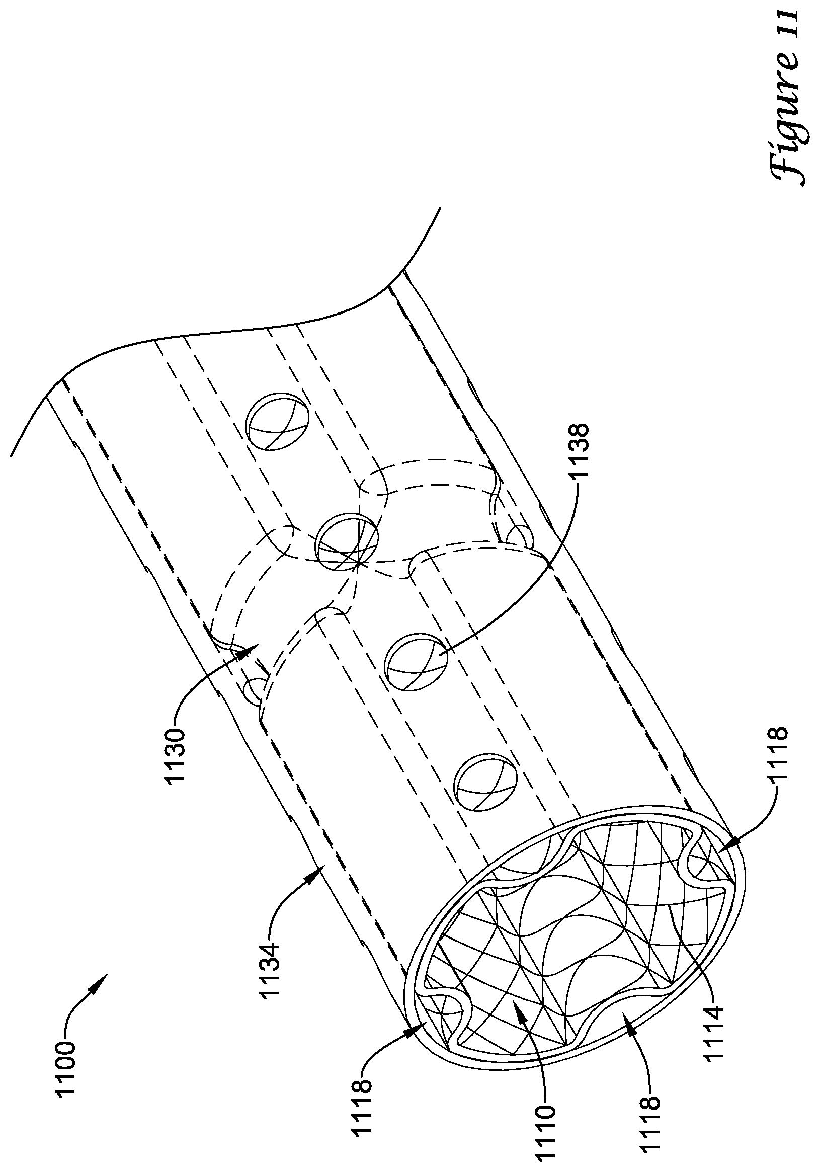 Patent US11779480 Figure 11 – Medical devices for use along the biliary and/or pancreatic tract