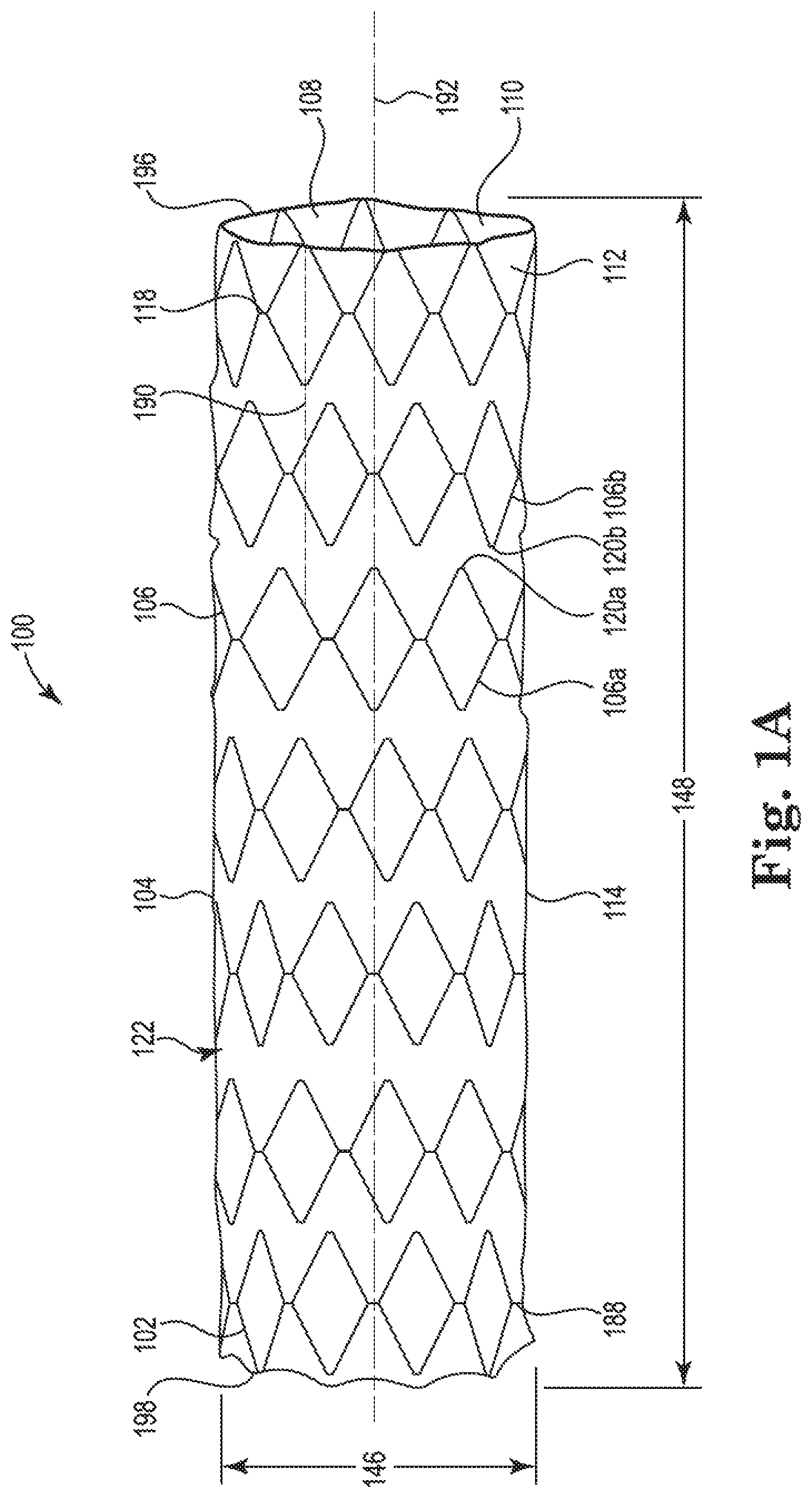 Patent US11779481 Figure 1 – Controlled endoprosthesis balloon expansion