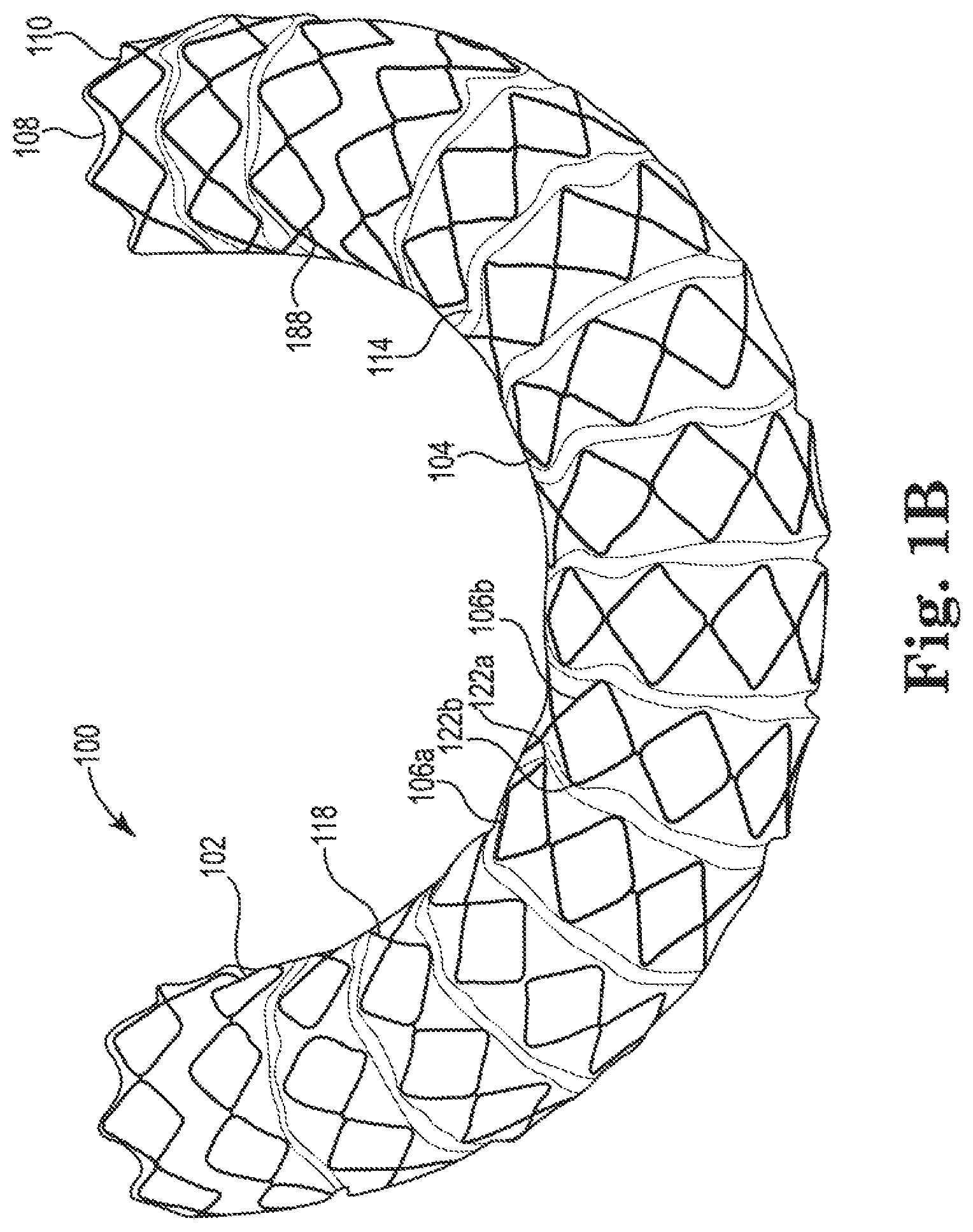 Patent US11779481 Figure 2 – Controlled endoprosthesis balloon expansion