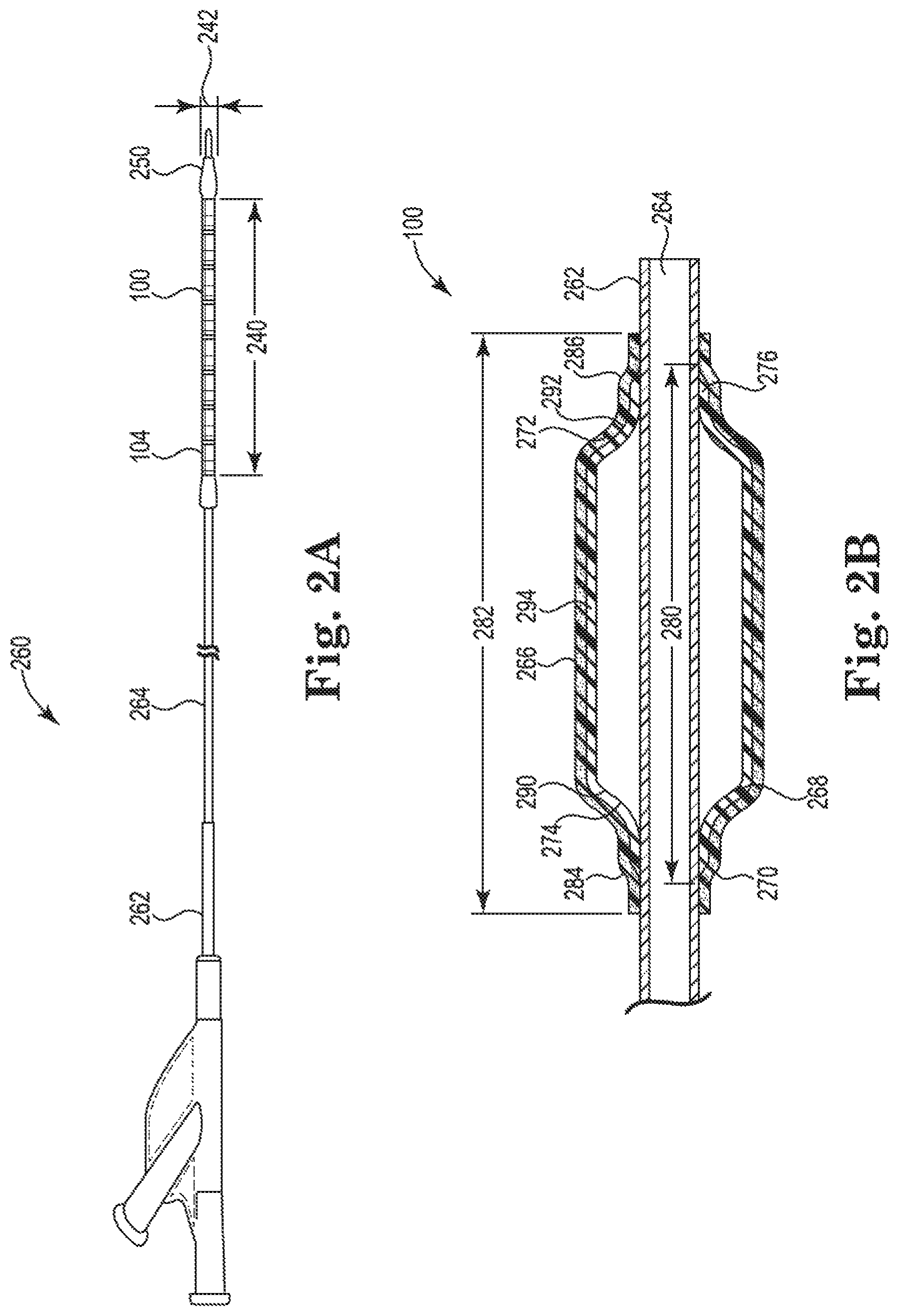 Patent US11779481 Figure 3 – Controlled endoprosthesis balloon expansion