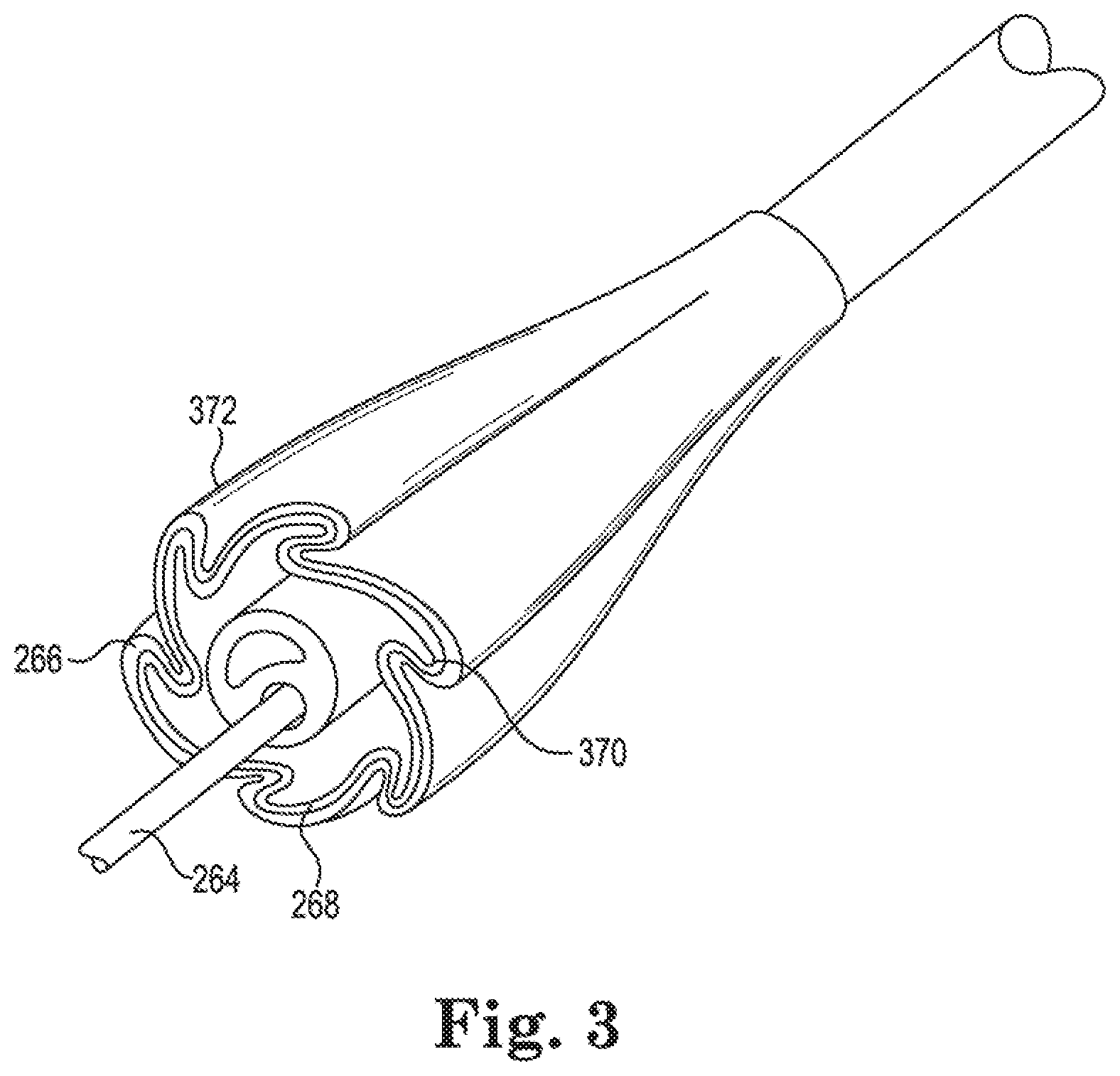 Patent US11779481 Figure 4 – Controlled endoprosthesis balloon expansion