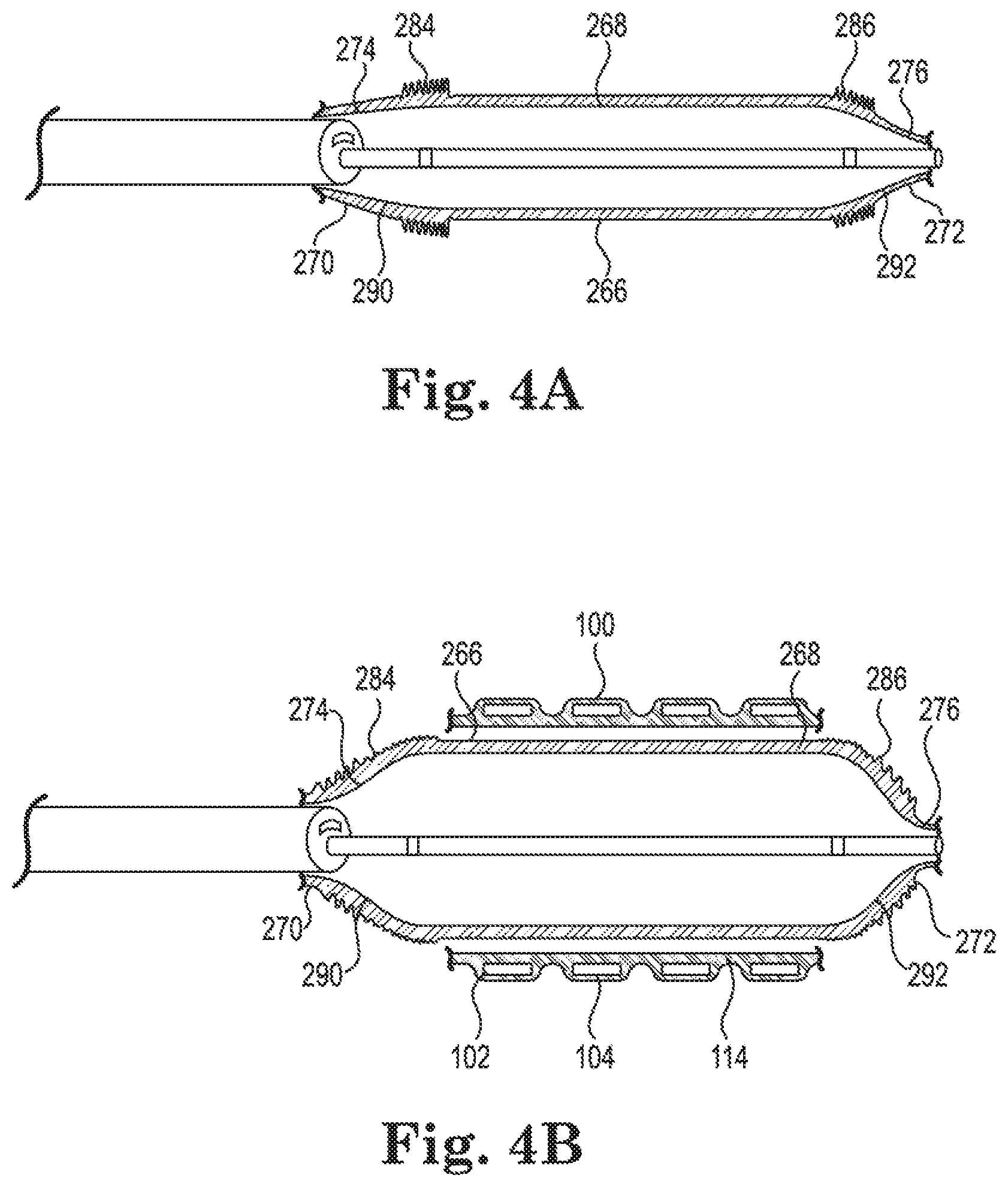 Patent US11779481 Figure 5 – Controlled endoprosthesis balloon expansion