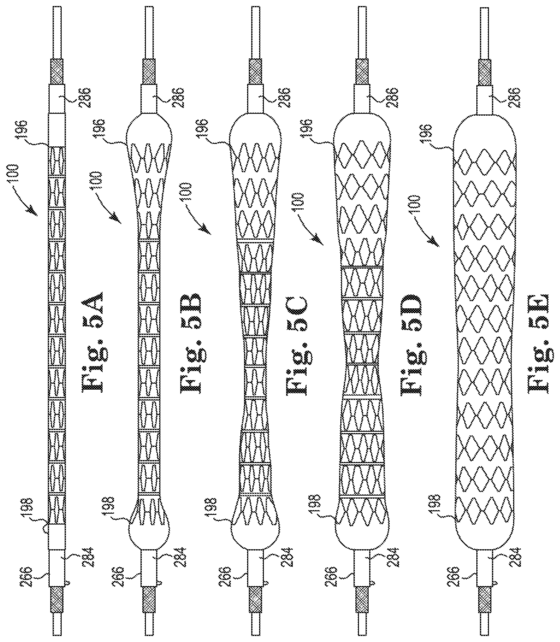 Patent US11779481 Figure 6 – Controlled endoprosthesis balloon expansion